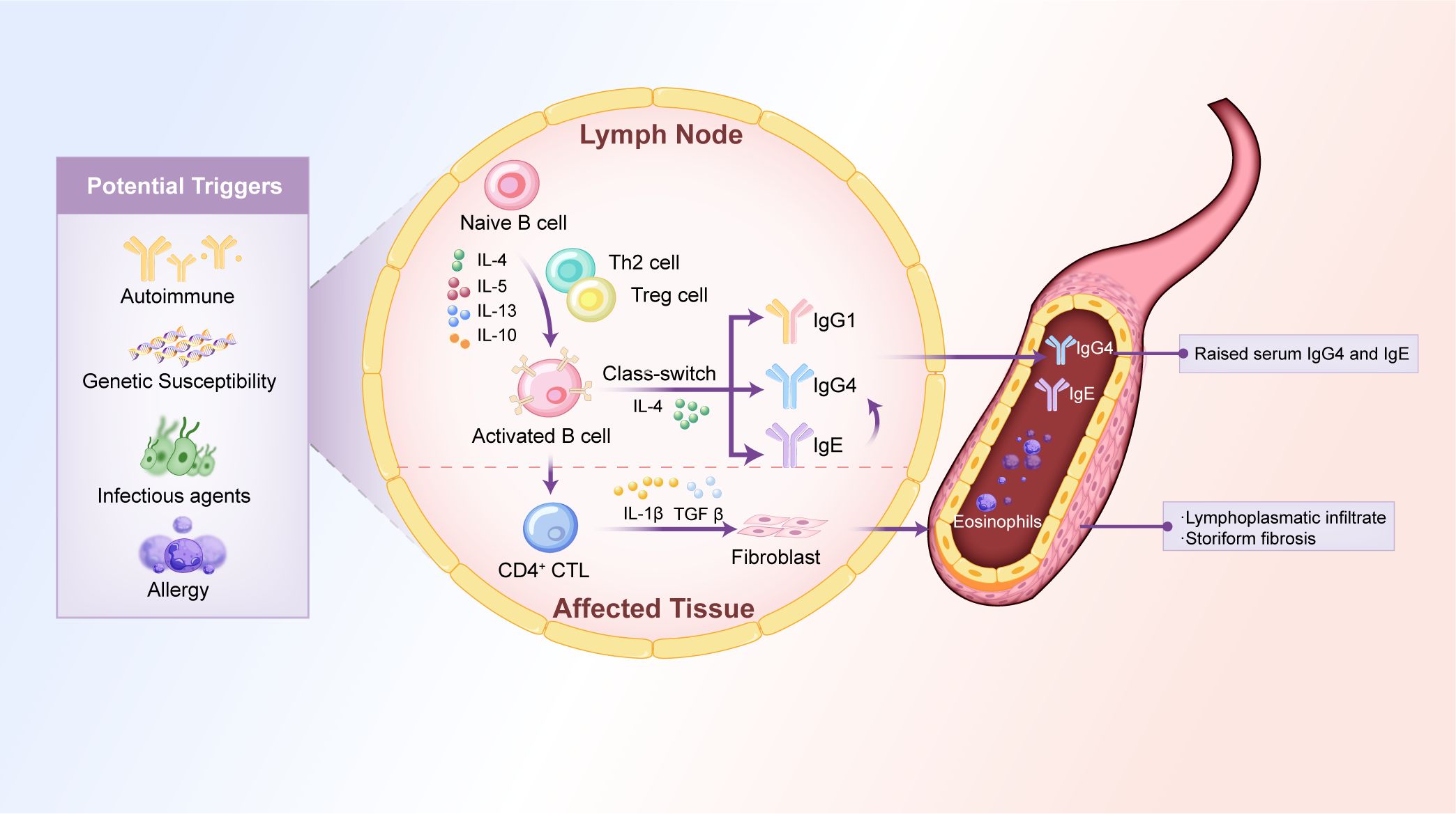Diagram illustrating the immune response in lymph nodes and affected tissues, highlighting potential triggers like autoimmune, genetic susceptibility, infectious agents, and allergy. Labels show interactions involving Naive B cells, Th2 cells, Treg cells, and class-switch to IgG1, IgG4, and IgE antibodies. Raised serum IgG4 and IgE, eosinophils, lymphoplasmatic infiltrate, and storiform fibrosis are noted in the tissue on the right.