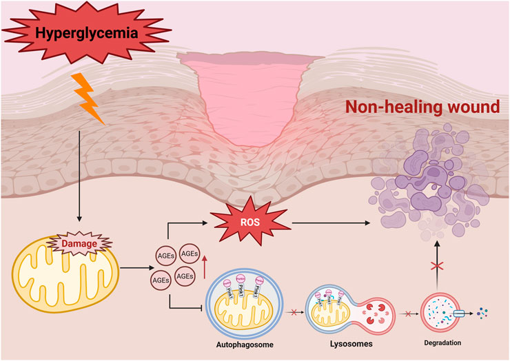 Diagram illustrating how hyperglycemia contributes to non-healing wounds. It shows damaged mitochondria, ROS production, and accumulation of AGEs. Autophagosomes and lysosomes are depicted, indicating failed degradation processes.