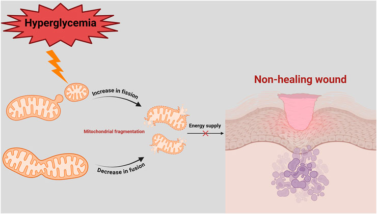 Diagram illustrating the impact of hyperglycemia on mitochondrial function. Hyperglycemia increases mitochondrial fission and decreases fusion, causing fragmentation. This disruption in energy supply contributes to non-healing wounds, depicted as an open sore on skin tissue.