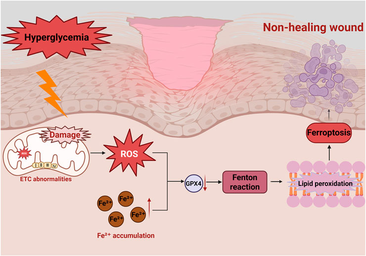 Diagram illustrating the process from hyperglycemia leading to a non-healing wound through various steps. Hyperglycemia causes mitochondrial damage and reactive oxygen species (ROS) production. Excess Fe2+ accumulates, and ROS reduces GPX4 activity, leading to the Fenton reaction and lipid peroxidation, ultimately resulting in ferroptosis and impairing wound healing.