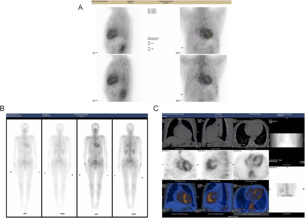 Image divided into three sections labeled A, B, and C. Section A includes two grayscale images with labeled measurements and highlighted circles. Section B shows four full-body grayscale scans in anterior and posterior views. Section C contains multiple cross-sectional images, including grayscale and color-enhanced scans, featuring different planes and details, with hospital and study information indicated at the top.