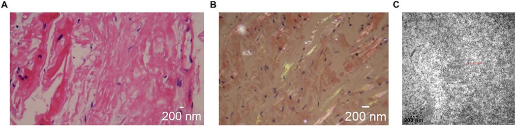Panel A shows a histological section with pink-stained fibrous tissue and scattered dark nuclei. Panel B depicts tissue with a brownish tint and scattered dark nuclei. Panel C presents a black and white textured image at a higher magnification, labeled 200 nanometers.