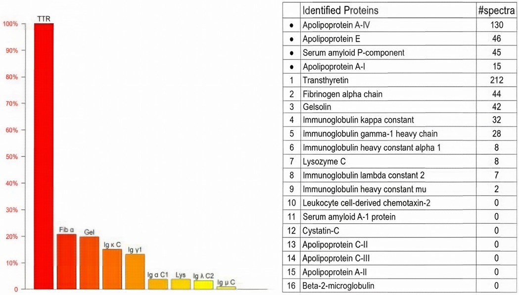 Bar graph and table showing the distribution of identified proteins. The bar graph indicates Transthyretin (TTR) comprises 100%. The table lists proteins with their spectra count: Transthyretin (212), Apolipoprotein A-IV (130), among others, with some proteins like Serum amyloid A-1 having zero spectra.