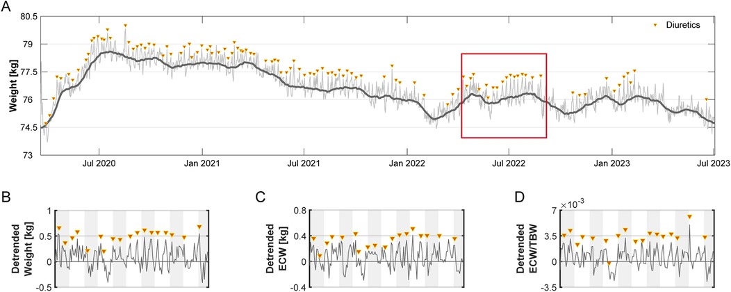 Panel A shows a weight trend graph from July 2020 to July 2023, with individual data points fluctuating around a smoothed line. Yellow triangles indicate diuretic usage. A red box highlights data around July 2022. Panels B, C, and D display detrended data for weight, extracellular water (ECW), and ECW/total body water (TBW) ratio respectively, with similar usage indicators.