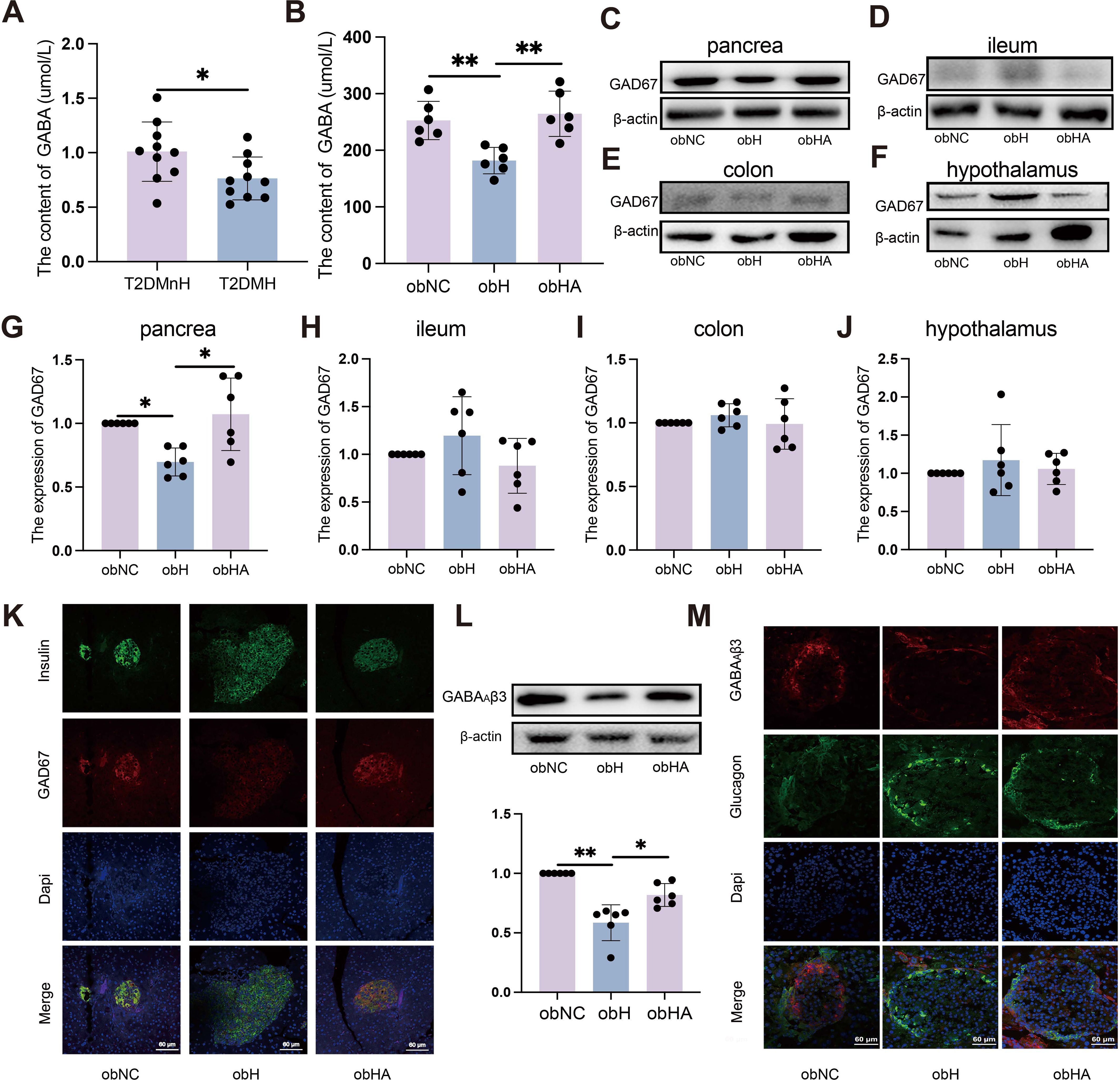 Bar graphs and Western blots show GABA content and GAD67 expression in different tissues (pancreas, ileum, colon, hypothalamus) of various groups (T2DMnH, T2DMH, obNC, obH, obHA). Panels A and B display GABA content, while panels G to J compare GAD67 expression. Panels C to F show Western blot bands for GAD67 and β-actin. Panel K presents immunofluorescence staining for insulin, GAD67, DAPI, and merged images in pancreatic sections. Panel L includes a Western blot and bar graph for GABAAβ3 expression, and panel M shows immunofluorescence images of GABAAβ3, glucagon, DAPI, and merged images. Scale bars indicate magnification levels.