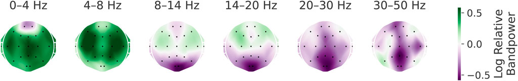 Series of six topographic head maps showing EEG activity across different frequency bands: 0-4 Hz, 4-8 Hz, 8-14 Hz, 14-20 Hz, 20-30 Hz, and 30-50 Hz. Colors range from green (higher power) to purple (lower power), with a scale bar indicating log relative band power from -0.5 to 0.5. Each map displays varying patterns of activity across the scalp with marked electrode positions.
