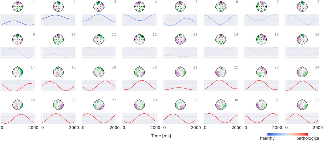 EEG topographical maps and waveforms for thirty-two different conditions display various brain signal patterns labeled one to thirty-two. Each panel includes a circular head map with color-coded brain activity, ranging from blue for healthy patterns to red for pathological patterns, accompanied by a corresponding waveform chart plotting time in milliseconds against signal intensity. The layout visually compares brain activities across different states.