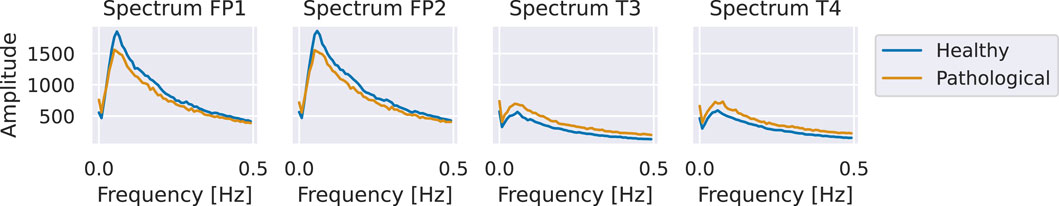 Four graphs compare spectra labeled FP1, FP2, T3, and T4, showing amplitude versus frequency in hertz. Each graph displays two lines: blue for healthy and orange for pathological. The blue line consistently peaks higher than the orange, indicating higher amplitudes for healthy conditions. Frequencies range from 0.0 to 0.5 hertz, with amplitudes from 0 to 1500.