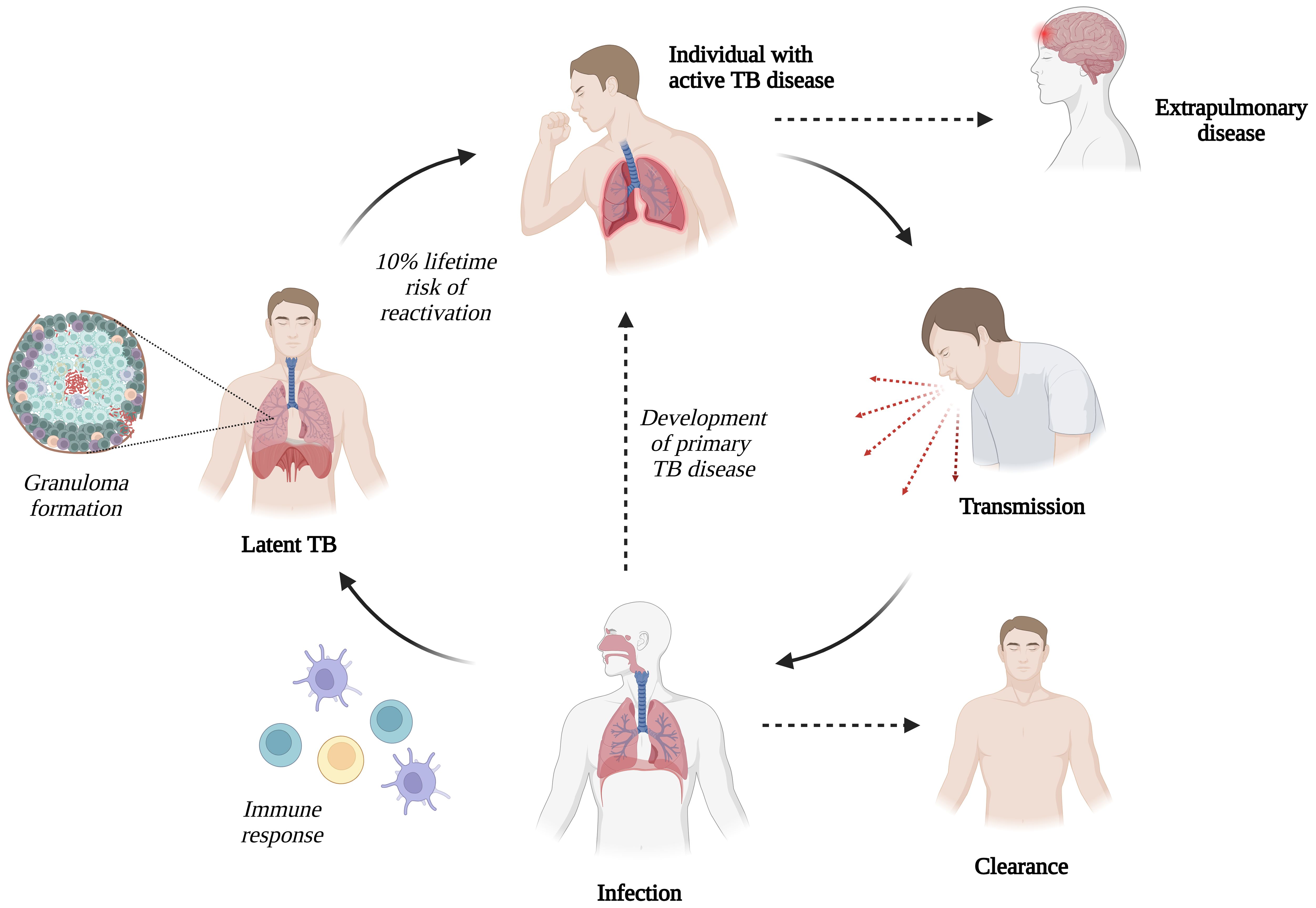 Flowchart illustrating tuberculosis progression. It begins with infection and either leads to latent TB or active TB and transmission. Adaptive and innate immunity, represented by illustrations, play a role. Granuloma formation is shown, indicating the body's response. Arrows depict the progression from infection to different immune responses and outcomes.