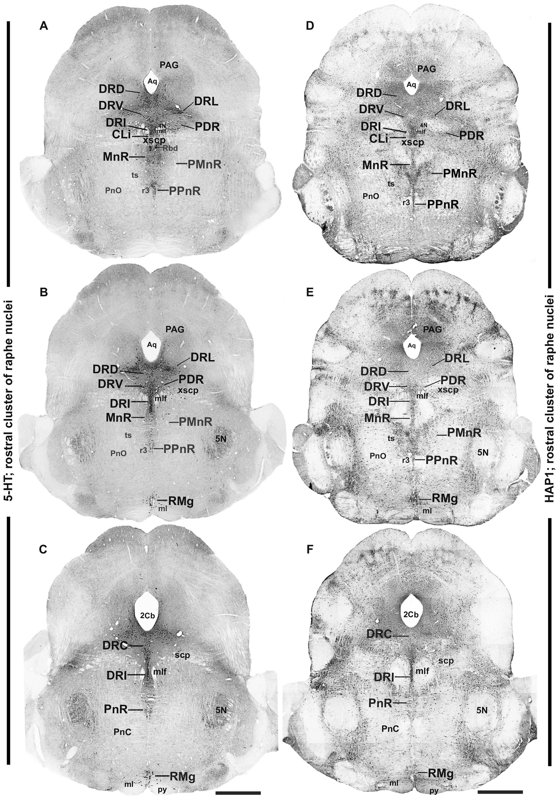 Six black and white brain section images, labeled A to F, showing the rostral cluster of raphe nuclei. Each image highlights various brain regions with labels like DRD, DRV, DRL, PnO, and more. Panels on the left are under