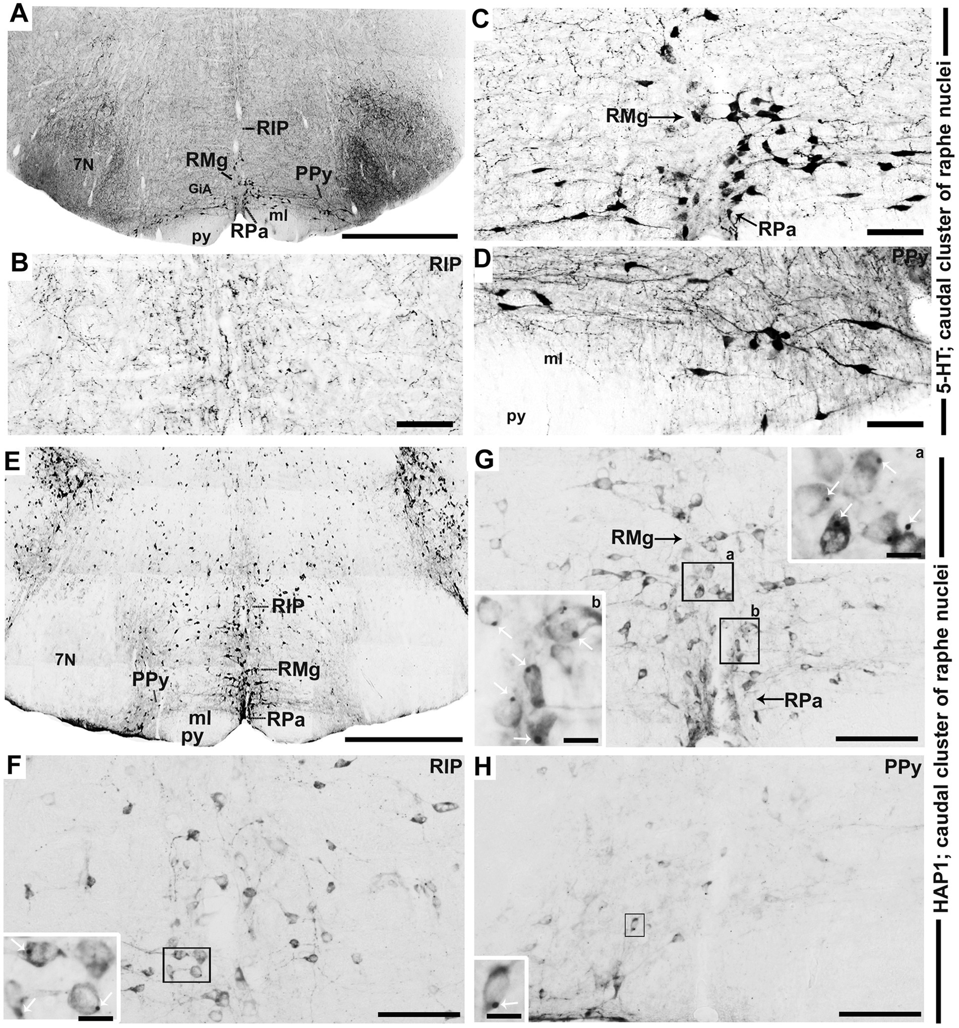 Series of grayscale microscopy images showing detailed sections of brain tissue with labeled areas, including RMg, RIP, RPa, PPy, and 7N. Insets highlight specific cellular structures with arrows pointing to detailed features. Different panels illustrate various regions and staining techniques to emphasize cellular organization and distribution of specific proteins or neurotransmitters in the caudal cluster of raphe nuclei. Scale bars indicate magnification.