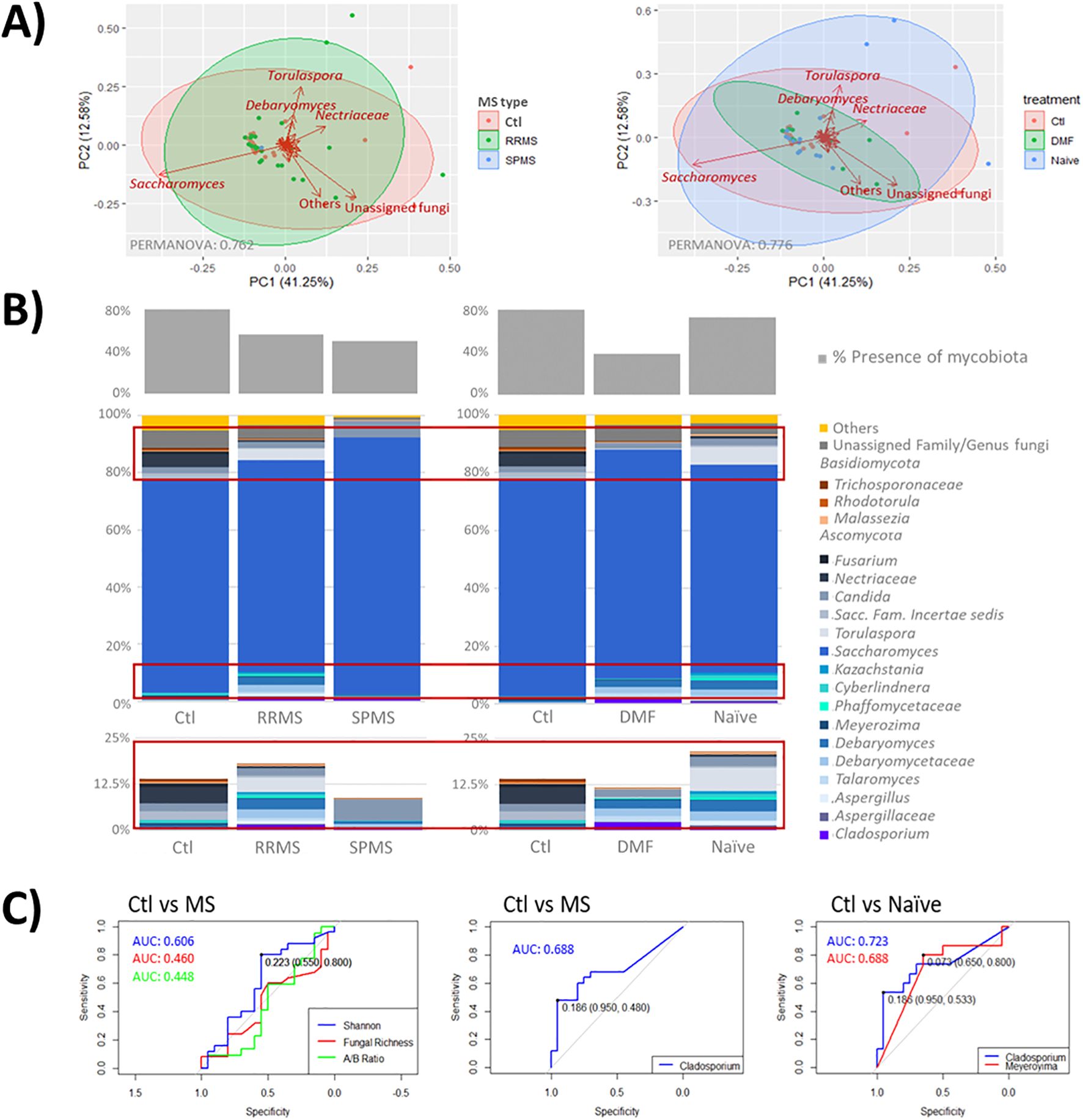 A) Two PCA plots showing microbiota composition differences based on MS type and treatment with variance explained by PC1 and PC2. B) Stacked bar charts depicting the percentage presence of various fungi across different conditions. C) ROC curves comparing Ctl vs MS, and Ctl vs Naïve with AUC values for Shannon index, fungal richness, and AB Ratio.