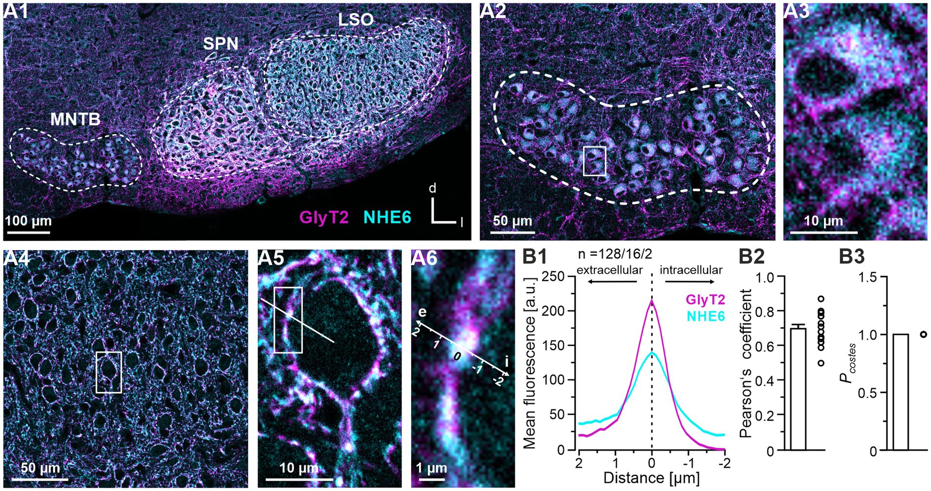 Fluorescent microscopy images and graphs showing a region with structures labeled as SPN, MNTB, and LSO. The images highlight GlyT2 in magenta and NHE6 in cyan. Panels A1-A6 display cellular structures at varying magnifications, focusing on fluorescent markers. Graph B1 shows a fluorescence intensity profile, while graphs B2 and B3 display statistical data related to Pearson’s correlation coefficient and Costes’ test. Scale bars indicate measurements from 1 micrometer to 100 micrometers.