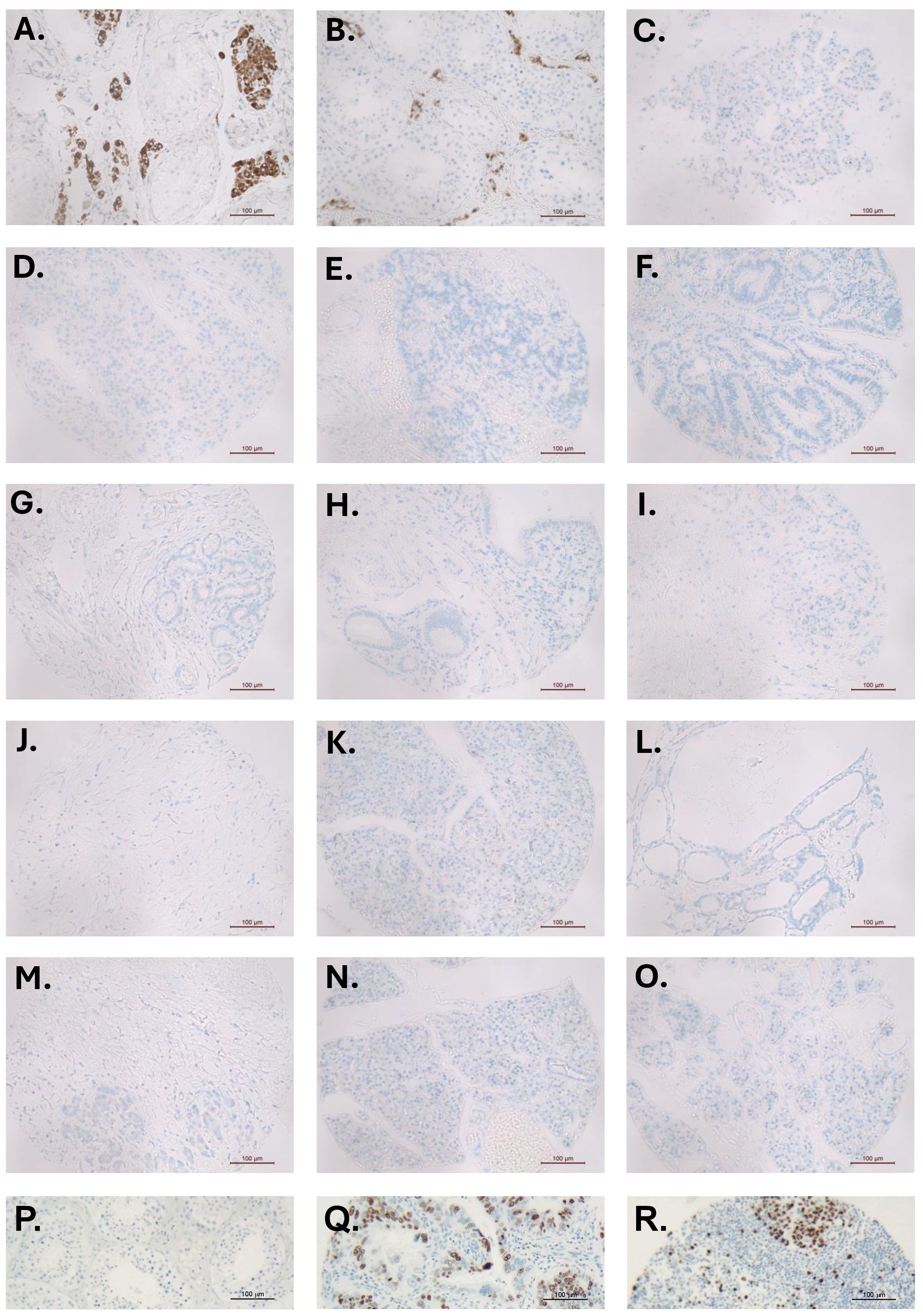 Microscopic images labeled A to R show different human tissue samples under similar staining conditions. Panels A, B, Q and R exhibit brown staining indicating specific expression in contrast to other pane;s which are relatively unstained indicating no expression. Each image includes a scale bar of 100 micrometres for reference.