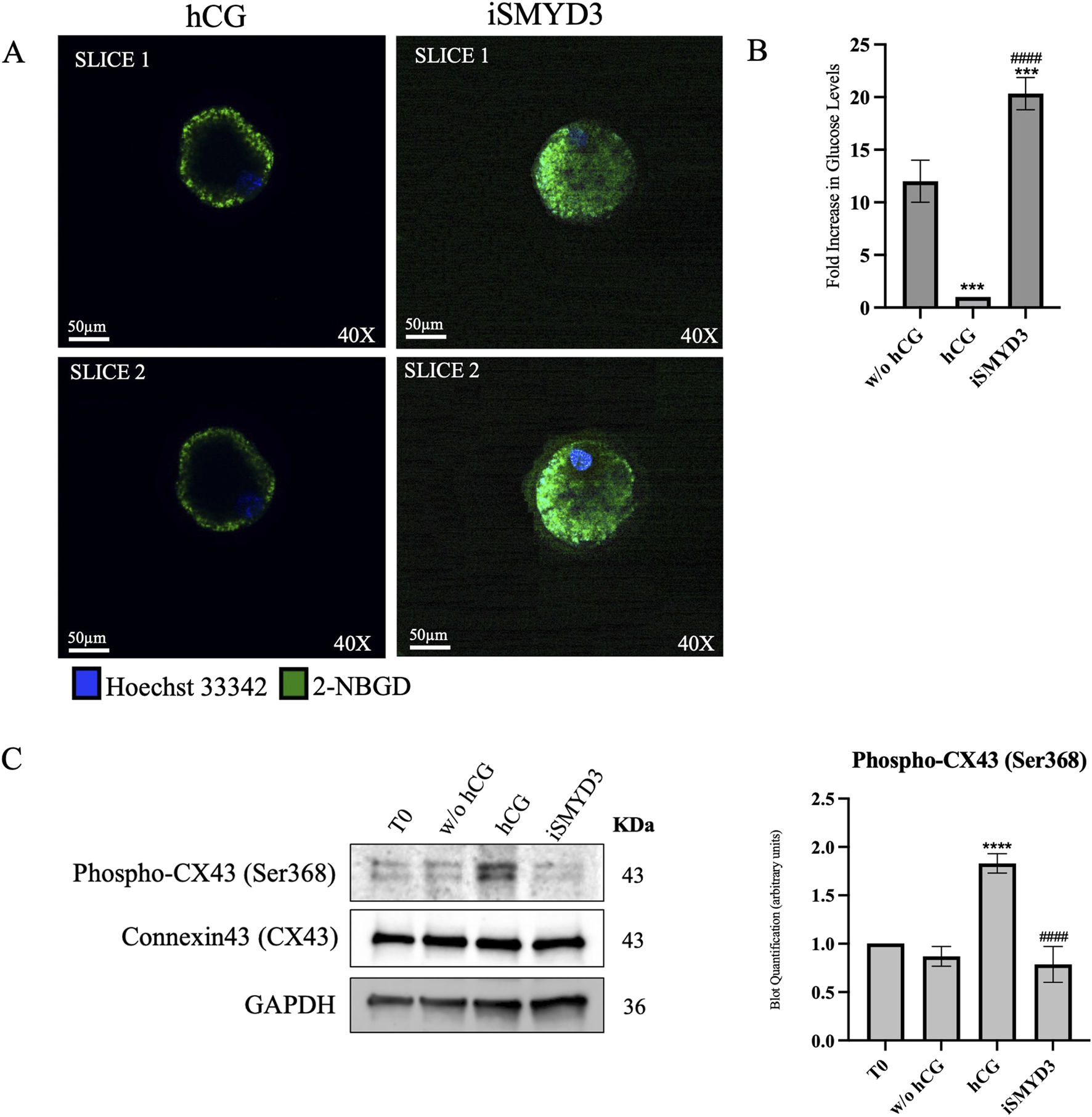Fluorescent microscopy and Western blot images reveal cellular and protein changes. Microscopy images show cells treated with hCG and iSMYD3, stained with Hoechst 33342 (blue) and 2-NBGD (green) at 40X magnification. A graph shows glucose level increases in cells treated with hCG and iSMYD3. The Western blot analysis displays proteins Phospho-CX43, Connexin43, and GAPDH across conditions T0, w/o hCG, hCG, and iSMYD3. A graph quantifies Phospho-CX43 levels, highlighting significant differences. Scale bars on microscopy images indicate 50 micrometers.