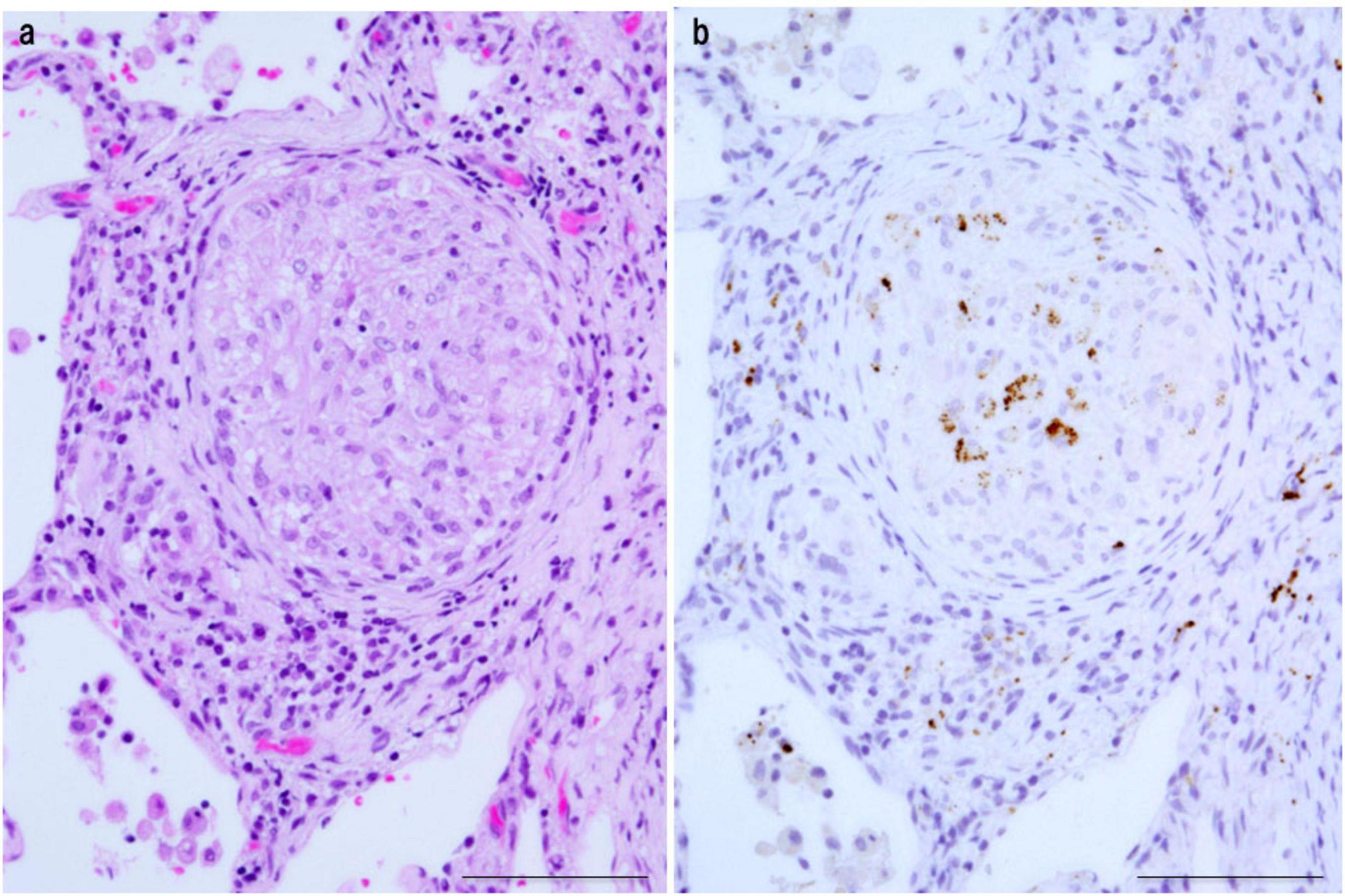 Two microscopic images labeled “a” and “b” showing a circular arrangement of cells. Image “a” is stained pink and purple, highlighting cellular structures. Image “b” shows mainly brown staining, indicating different cellular components or reactions. Both images show similar patterns but differ in staining techniques used.