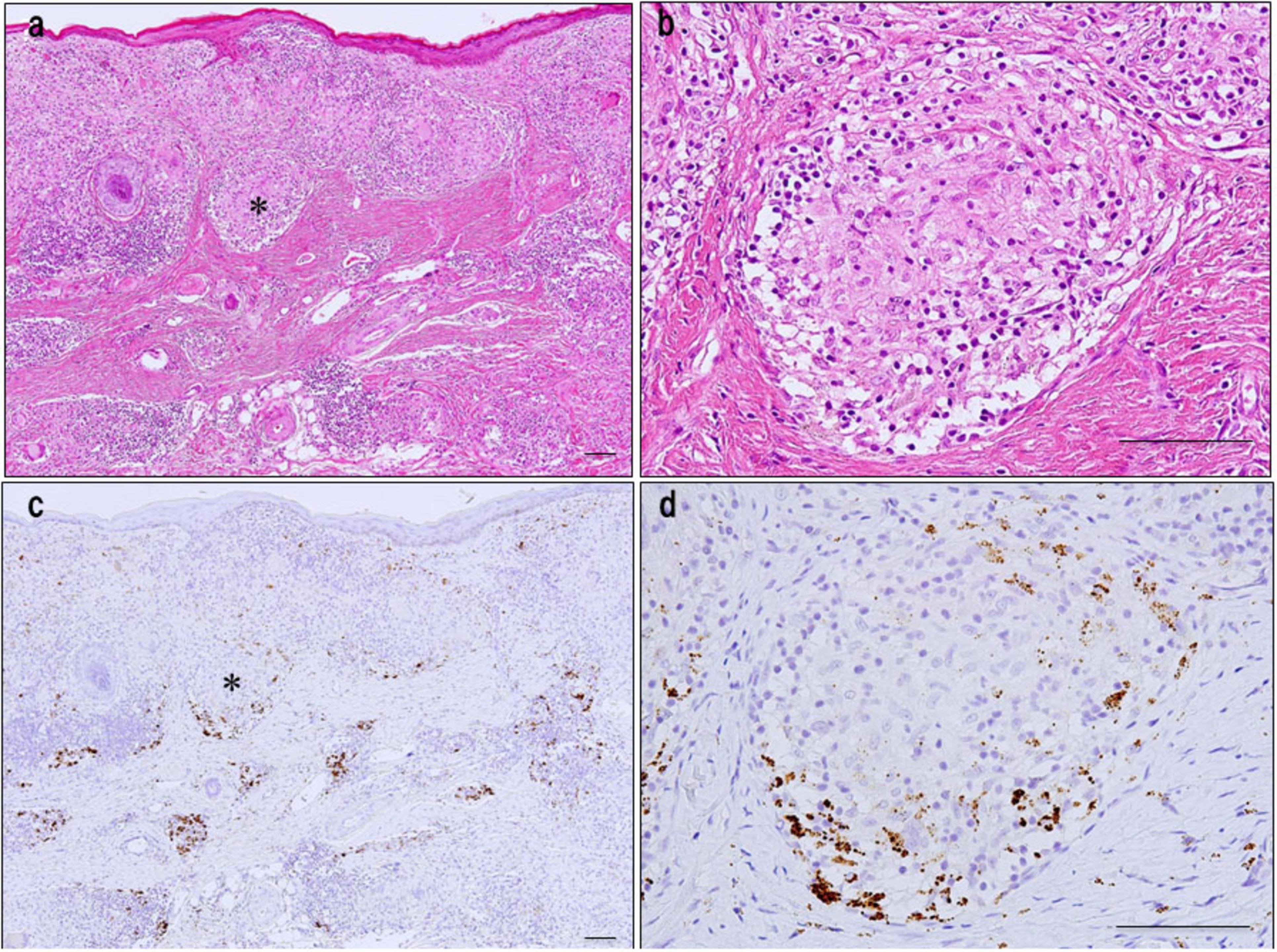 Histological images showing tissue samples in two rows. Top left (a) shows a broad view with a dark star marking an area; top right (b) is a closer view of compact cell structures. Bottom left (c) is a stained version similar to (a) with a dark star; bottom right (d) shows a detailed view with brown staining indicating specific features within cells.