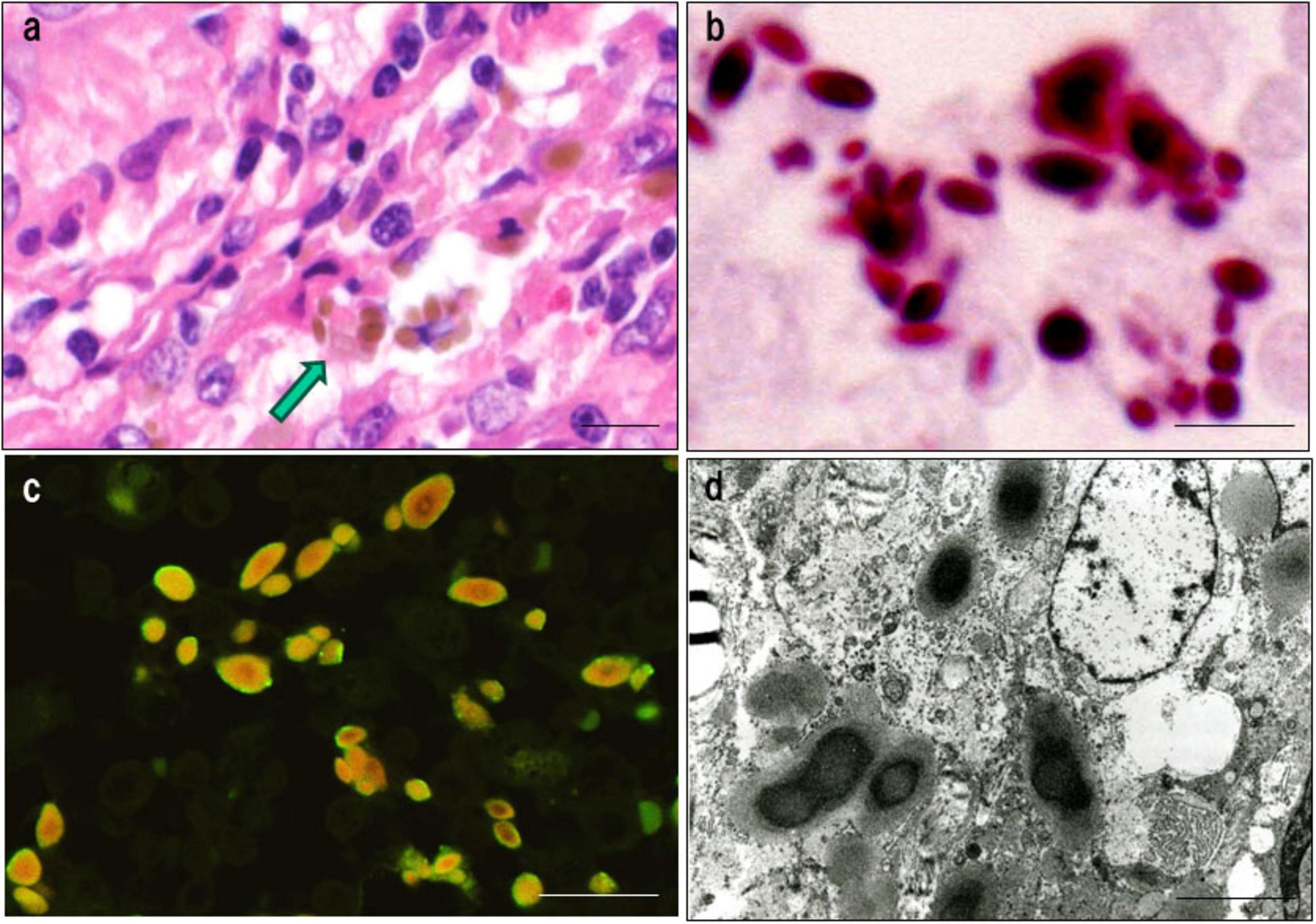 Four-panel composite showing different microscopic images of fungi in tissues. (a) Tissue with fungal structures visible, highlighted by an arrow. (b) Bright pink-stained fungal structures on a pale background. (c) Fluorescence image showing yellow-green and orange-stained cells. (d) Black and white electron microscopy revealing detailed fungal structures within the tissue.