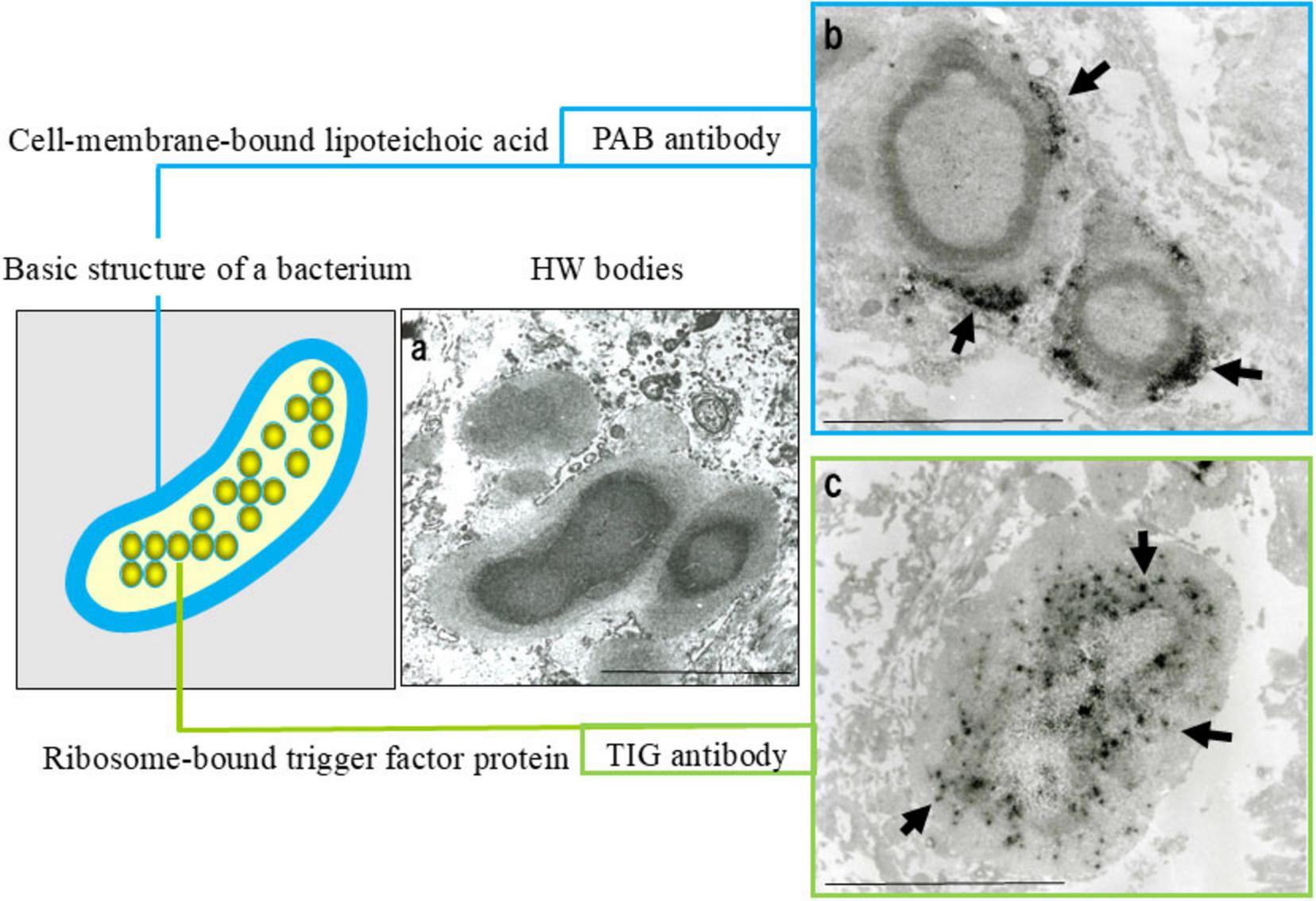 Diagram showing the structure of a bacterium, with labeled components: cell-membrane-bound lipoteichoic acid linked to PAB antibody, ribosome-bound trigger factor protein linked to TIG antibody, and HW bodies. Microscopic images depict the PAB antibody highlighting cell membranes (b) and the TIG antibody highlighting ribosome-bound proteins (c) with arrows pointing at specific areas.
