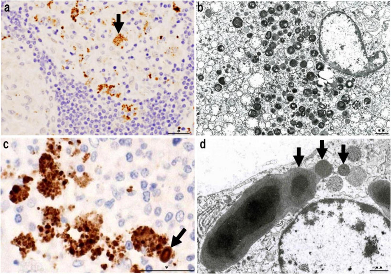 Panel of four micrographs showing cellular structures. Panel a: Light micrograph with brown-stained areas and a black arrow pointing to a cluster. Panel b: Electron micrograph showing a dense arrangement of circular structures. Panel c: Close-up light micrograph highlighting darker brown clusters indicated by an arrow. Panel d: Electron micrograph showing large cellular bodies with black arrows pointing to them. Each panel reveals different magnifications and details of cellular features.