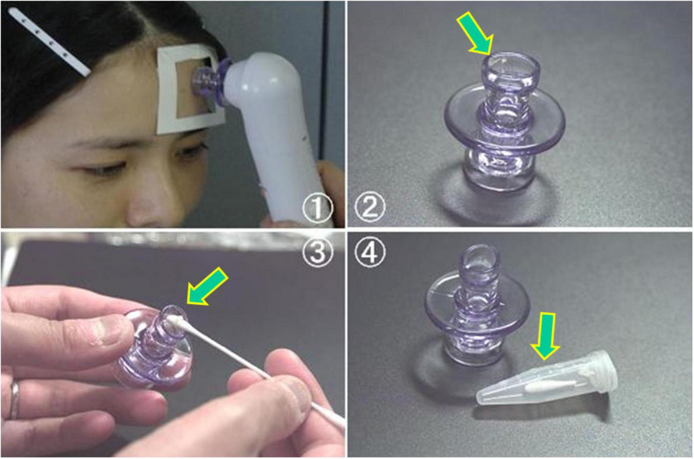 Panel 1 shows a person undergoing a skin procedure with a handheld device on the forehead. Panel 2 displays a close-up of a clear, cylindrical plastic component. Panel 3 depicts the component being cleaned with a cotton swab. Panel 4 shows the component next to a clear plastic tube cap.