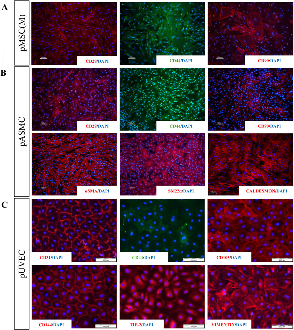 Fluorescent microscopy images showing immunostaining of different cell types. Panel A displays pMSC (M) with markers CD29, CD44, and CD90. Panel B illustrates pASMC with markers CD29, CD44, CD90, αSMA, SM22α, and CALDESMON. Panel C shows pUVEC with markers CD31, CD44, CD105, CD144, TIE-2, and VIMENTIN. Each image highlights specific cellular markers in red or green, with nuclei counterstained in blue using DAPI.