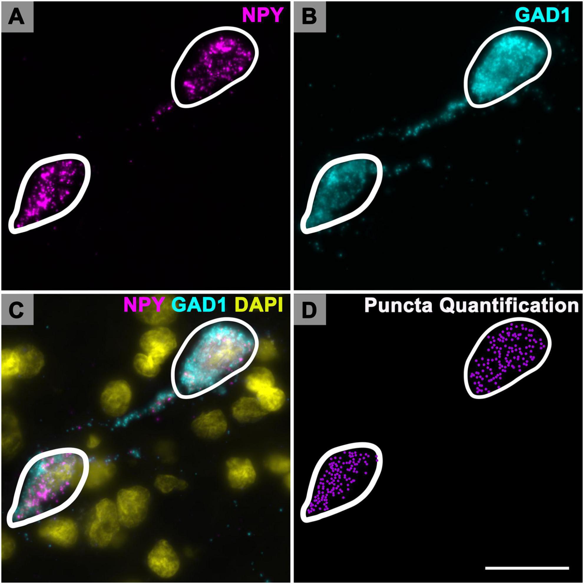 Four-panel microscopic image showing stained cells. Panel A highlights NPY in magenta. Panel B displays GAD1 in cyan. Panel C shows NPY, GAD1, and DAPI combined in magenta, cyan, and yellow, respectively. Panel D focuses on puncta quantification as magenta dots. Each panel is labeled and distinct cellular structures are outlined in white.