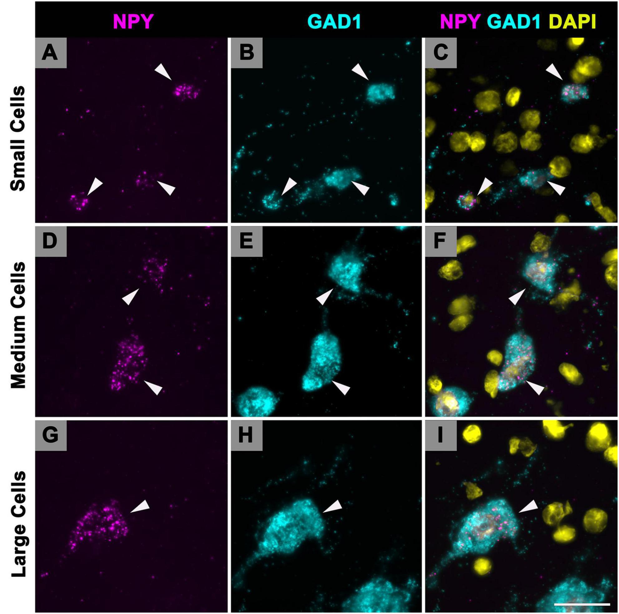 Fluorescent microscopy images showing small, medium, and large cells. Columns A, D, G display NPY in magenta, columns B, E, H show GAD1 in cyan, and columns C, F, I combine NPY, GAD1, and DAPI in yellow. Arrowheads indicate highlighted areas in each panel.