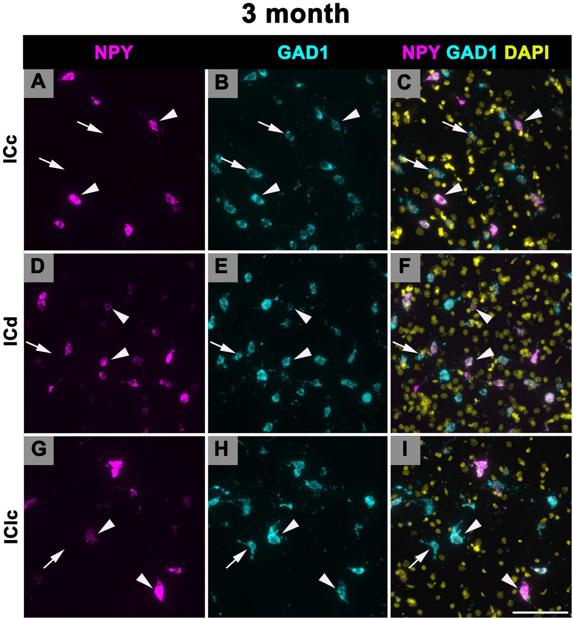 Labeled “3 month,” this image contains three rows and three columns, showing fluorescent microscopy results. The columns represent NPY (magenta), GAD1 (cyan), and a merged view with DAPI (yellow) stainings. The rows are labeled Icc, Icd, and IClc, with each panel displaying cellular structures highlighted by arrows and arrowheads. Panels A, D, and G show NPY; B, E, and H show GAD1; and C, F, I are the merged images displaying all markers together.