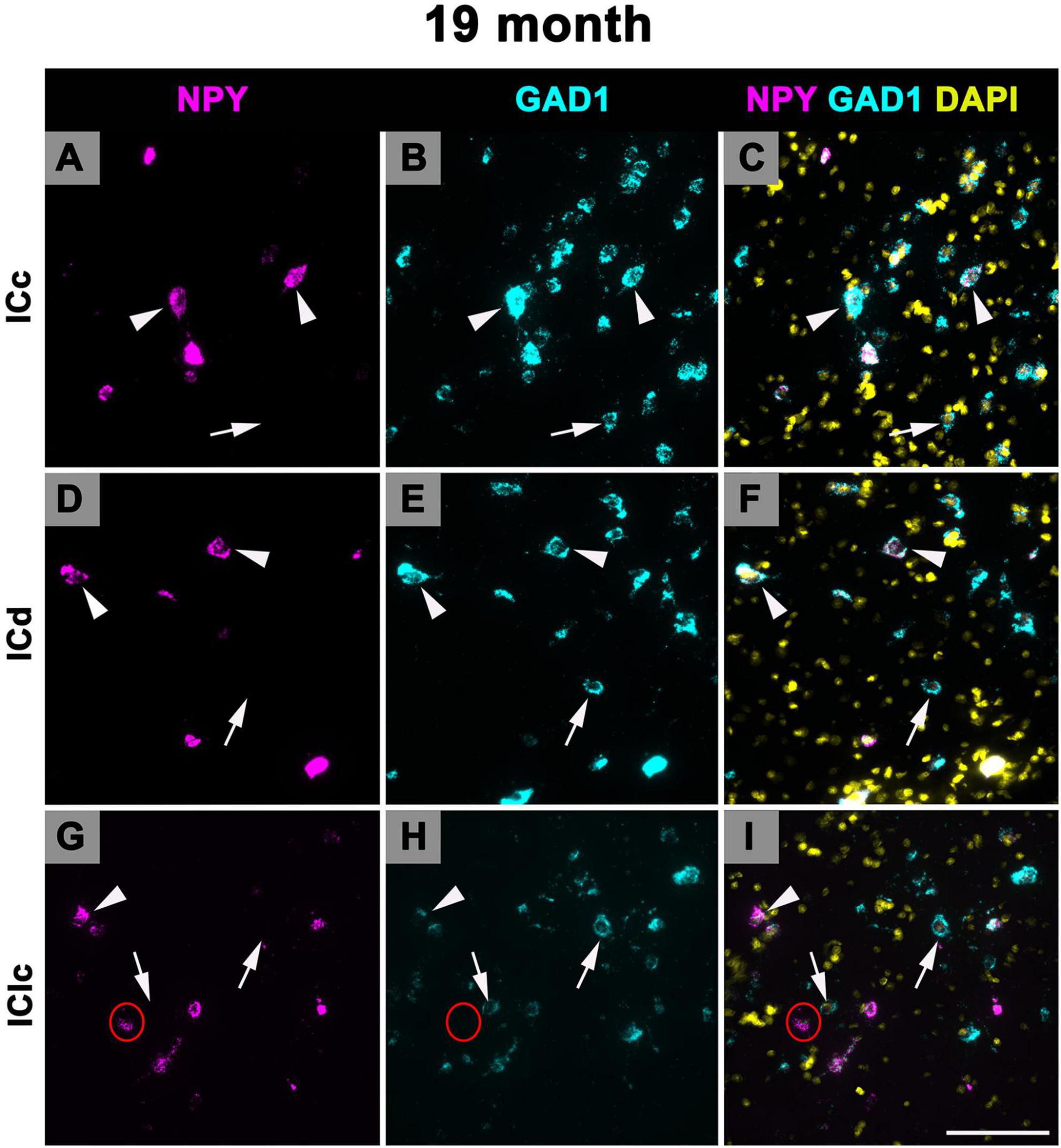 Fluorescent microscopy images labeled A to I showing brain sections at 19 months. Panels A, D, and G display NPY in magenta; B, E, and H show GAD1 in cyan; C, F, and I combine NPY, GAD1, and DAPI in yellow. Arrowheads and arrows indicate regions of interest. Circles appear in G and H. Sections are labeled ICc, ICd, and IClc.