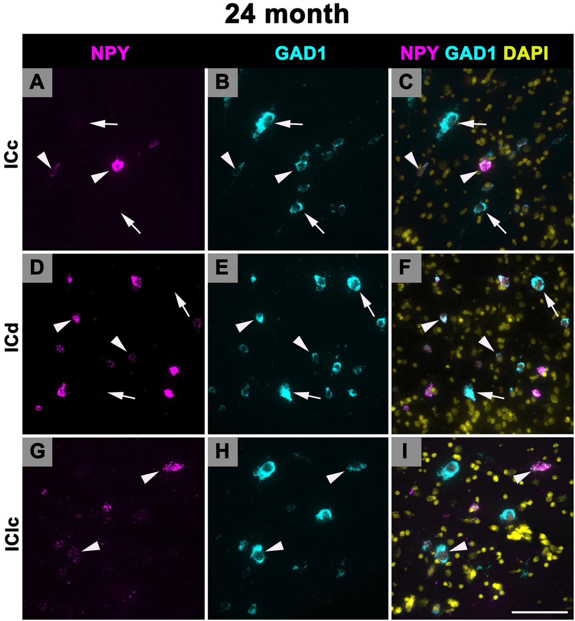 Fluorescent microscopy images of brain tissue at 24 months showing three markers: NPY in magenta, GAD1 in cyan, and DAPI in yellow. Panels A, D, and G show NPY, panels B, E, and H show GAD1, and panels C, F, and I show merged colors. Arrowheads and arrows indicate specific cell locations across the ICC, ICd, and IClc regions.