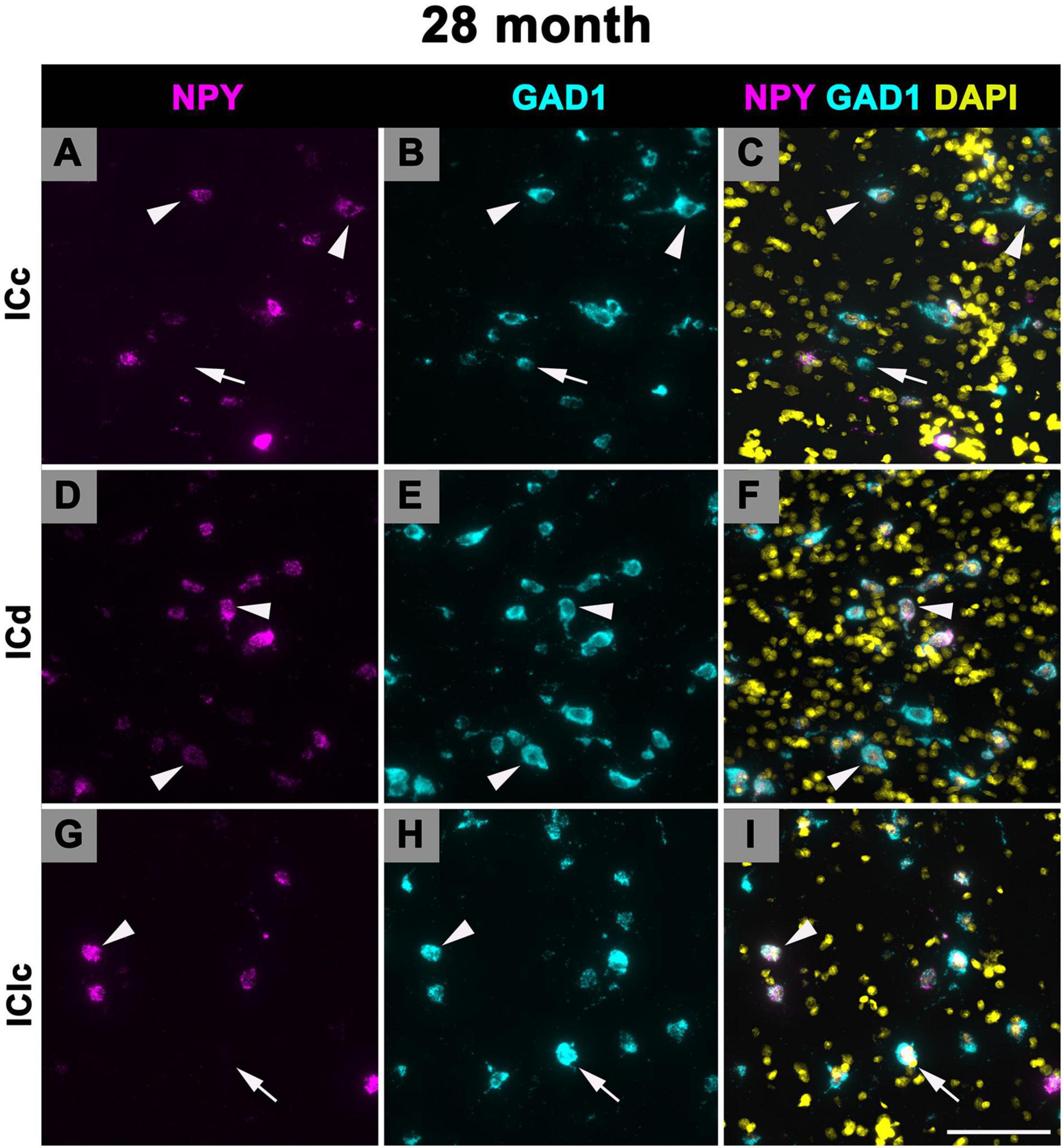Fluorescent microscopy images showing brain tissue at twenty-eight months. Panels A, D, and G display NPY in magenta. Panels B, E, and H show GAD1 in cyan. Panels C, F, and I combine NPY, GAD1, and DAPI staining, resulting in magenta, cyan, and yellow respectively. Each row represents different regions: ICc, ICd, and IClc. Arrowheads and arrows highlight specific areas or structures within the tissue.