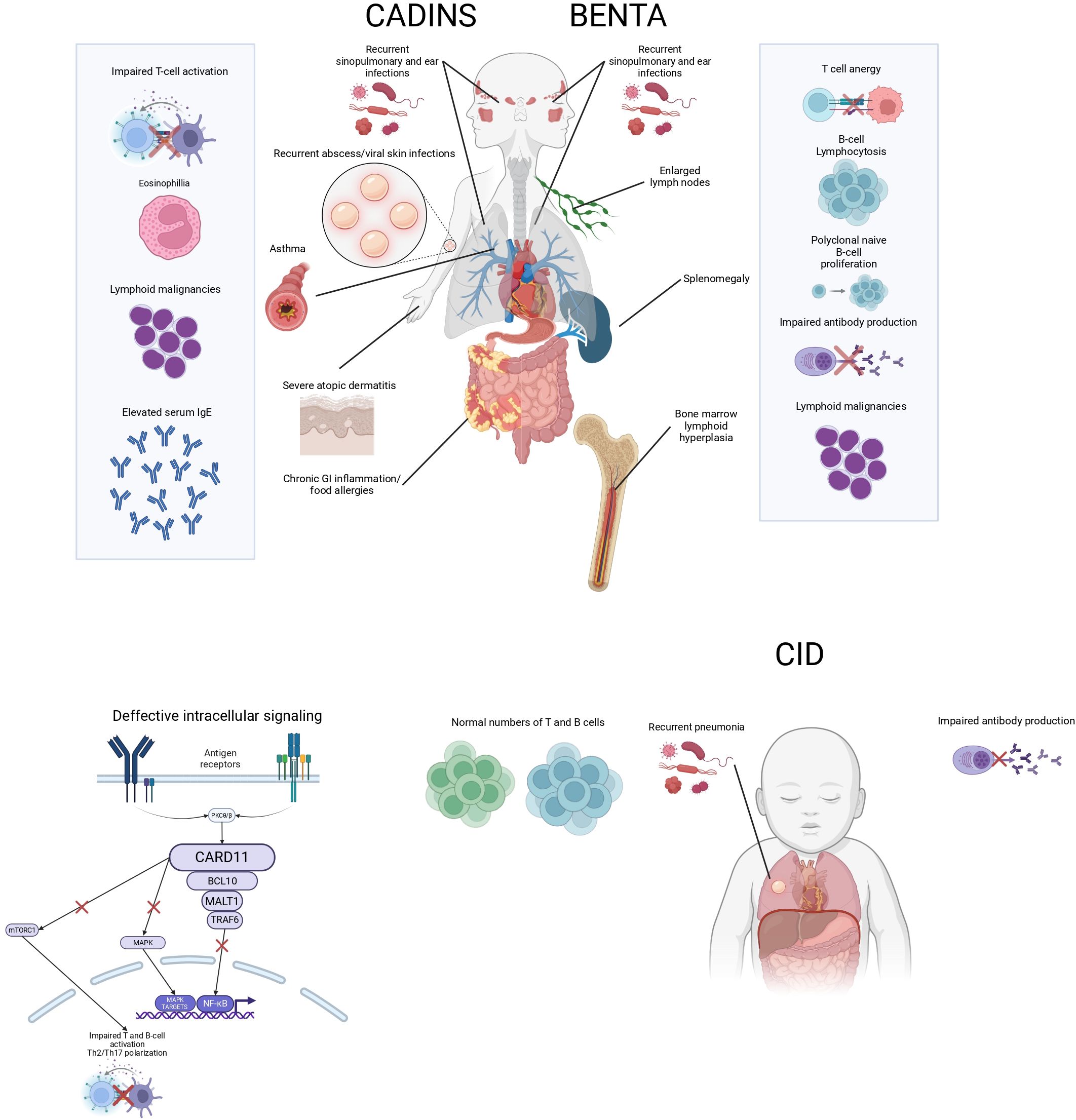 Diagram illustrating CADINS, BENTA, and CID syndromes. Symptoms include recurrent infections, skin conditions, and lymphoid malignancies. BENTA shows lymph node enlargement and splenomegaly. CADINS highlights asthma and atopic dermatitis. CID features T and B cell abnormalities. There is a depiction of defective signaling pathways and impacted immune responses.