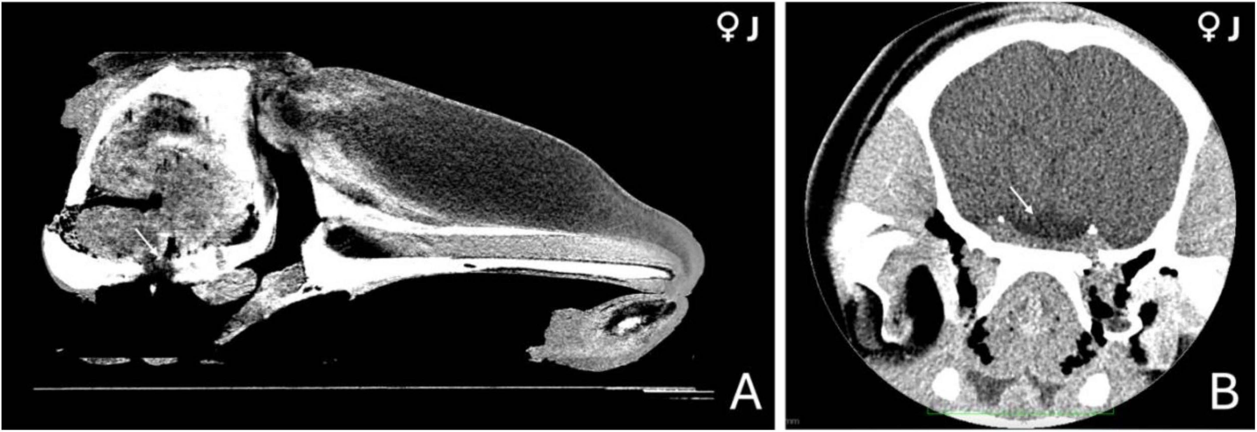 CT scan images of the head of a 3-year-old female orca. Panel A shows a mid-sagittal section highlighting the pituitary gland at the base of the skull. Panel B presents a coronal section at the hypothalamus level, showing a hypodense, highly vascularized region consistent with the hypophyseal vascular pad. Both images depict different tissue densities in shades of gray, illustrating key anatomical features relevant to the pituitary gland location.