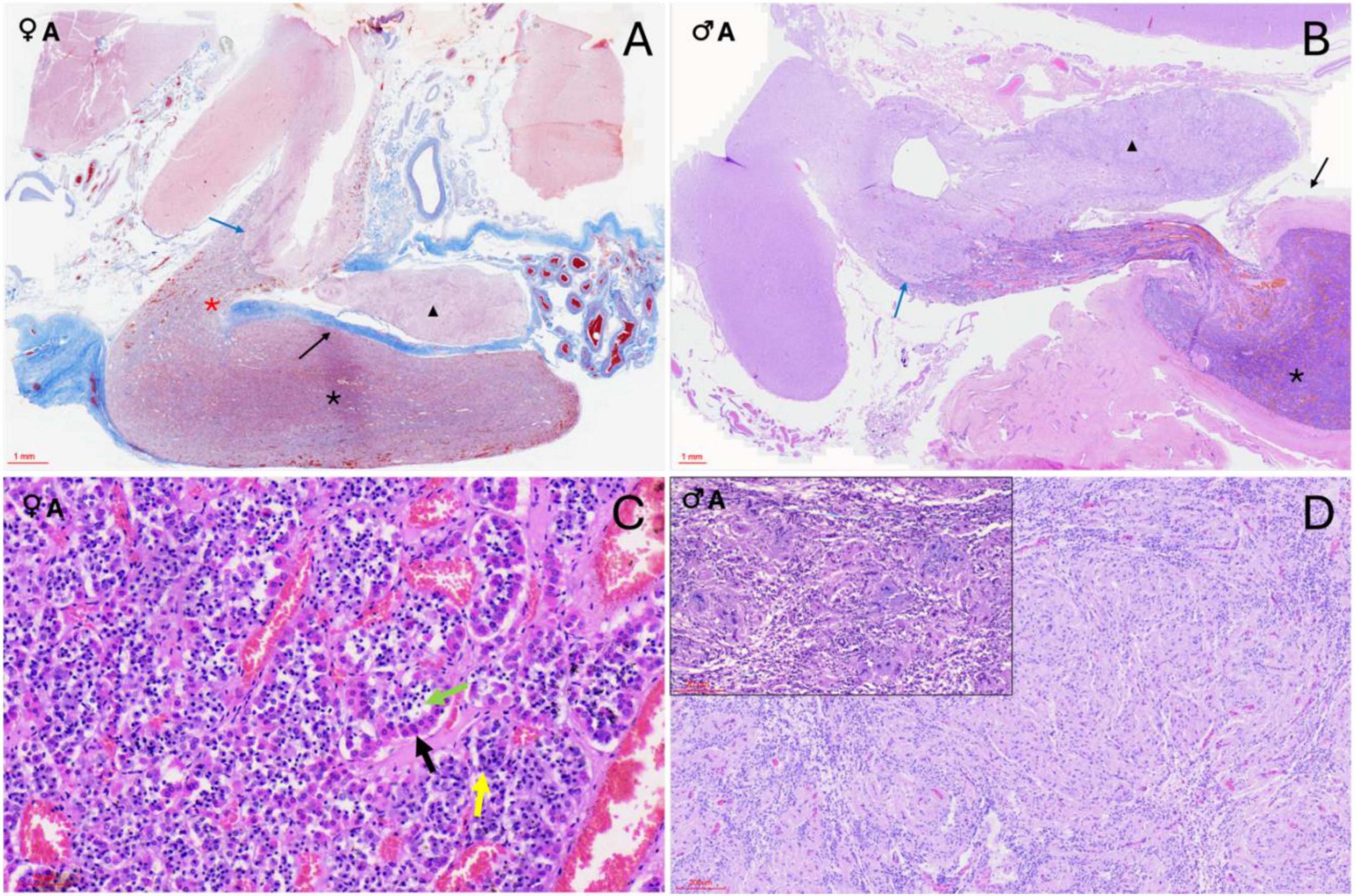 Histological sections of orca pituitary glands stained with Masson’s trichrome and Hematoxylin–Eosin. Panel A shows the neurohypophysis (black triangle) and adenohypophysis pars distalis (black asterisk) with a neuroendocrine interface (blue arrow). Panel B shows similar structures in a male specimen. Panel C highlights acidophils (black arrow), basophils (yellow arrow), and chromophobes (green arrow) arranged in cords. Panel D shows the neurohypophysis with an inset of Luxol fast blue stain revealing unmyelinated axons and capillaries.