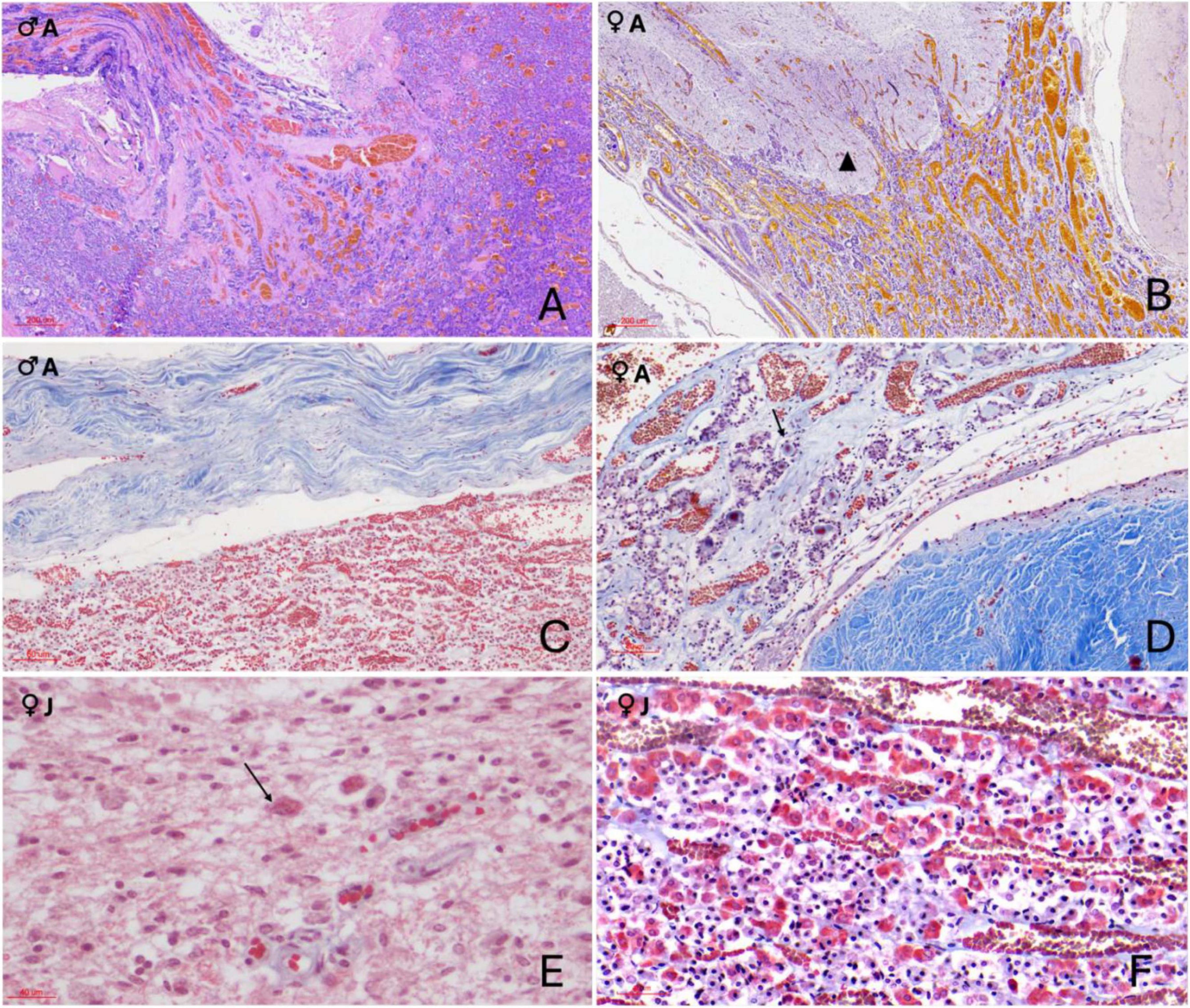 Histochemical images of the orca pituitary gland showing different staining techniques. Panel A (Hematoxylin–Eosin) reveals a highly vascularized pars tuberalis. Panel B (PAS–Orange G) shows the intricate neuroendocrine connection with intense vascularization. Panel C (Masson’s trichrome–Orange G) highlights the connective dural recess. Panel D reveals connective tissue around the gland and rosette-like endocrine cells between capillaries with red-stained extracellular material (black arrow). Panels E and F show nerve fibers, pituicytes, and granule aggregations (Herring bodies) with distinct staining patterns.