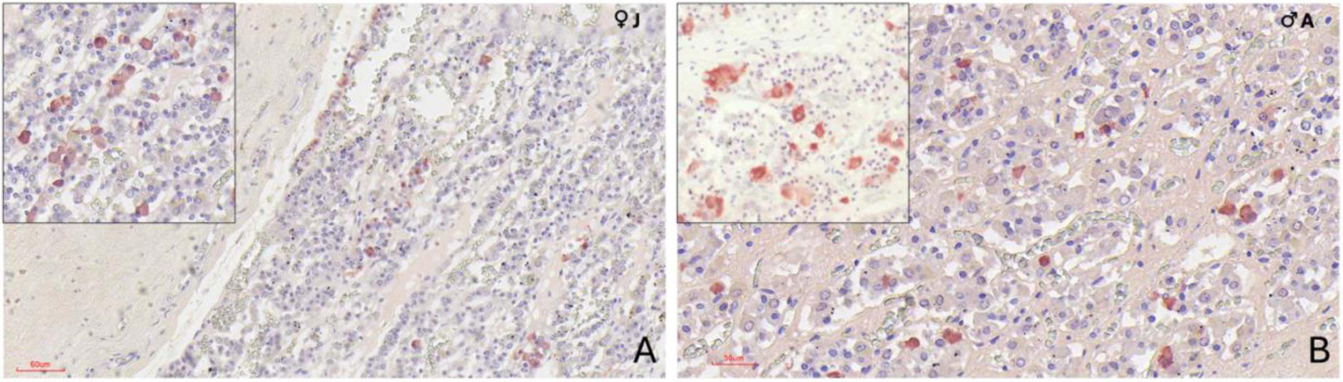 Immunohistochemical images of orca adenohypophysis labeled with anti-MSH and anti-TSH antibodies. Panel A shows MSH-positive cells in a juvenile female, mostly single or in small clusters in the dorsal pars distalis near the dural recess; the inset shows scattered MSH-positive cells. Panel B displays TSH-positive polygonal cells in an adult male, scattered individually with strong cytoplasmic staining; the inset shows enhanced contrast highlighting cytoplasmic labeling.