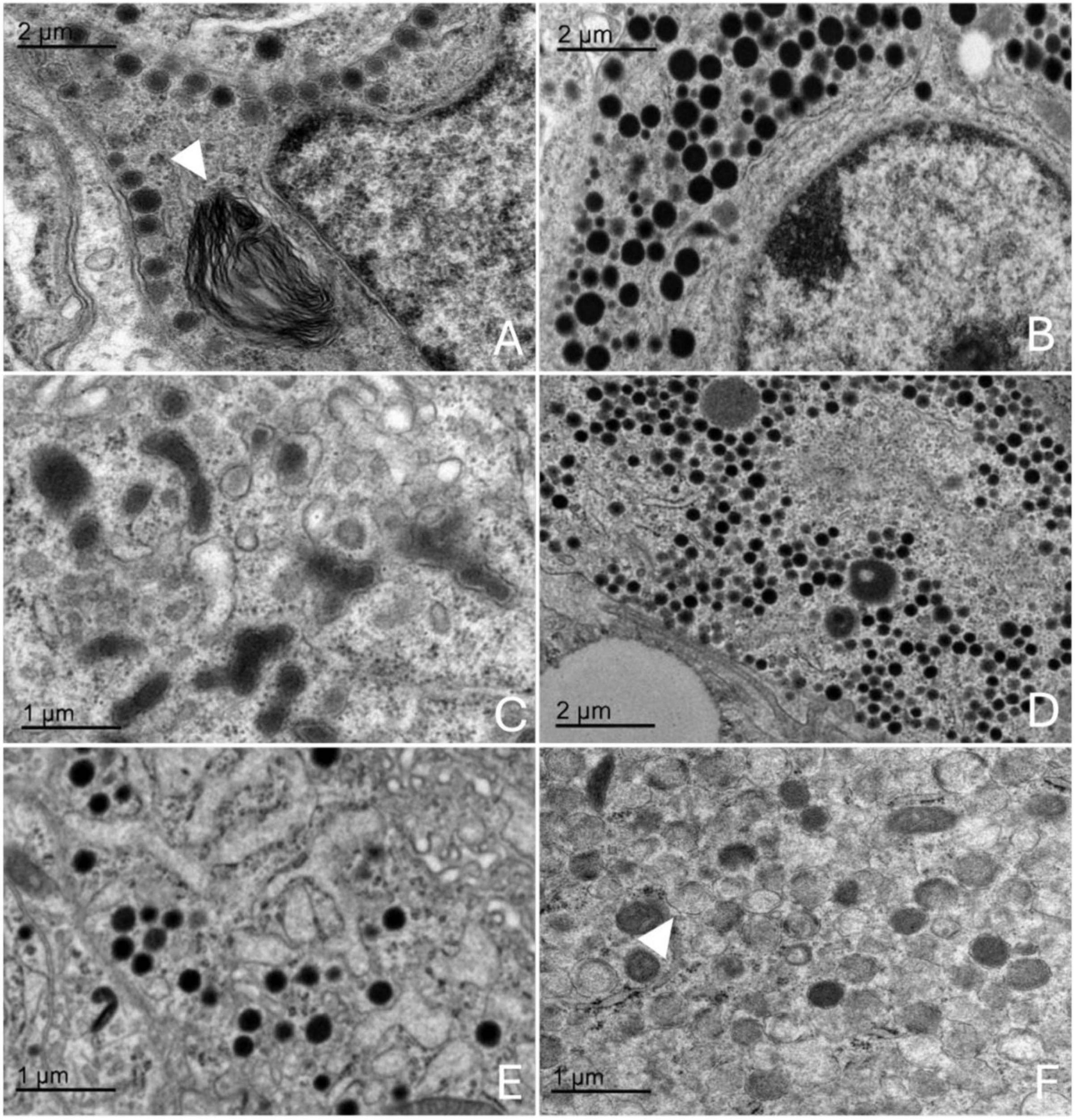 Transmission electron microscopy images of orca adenohypophysis showing different endocrine cell types. Panel A: corticotroph with small electron-dense granules near the membrane and a myelin figure (white triangle). Panel B: somatotroph with densely packed large granules. Panel C: lactotroph with pleomorphic granules of varied sizes. Panel D: gonadotroph with evenly distributed medium granules. Panel E: thyrotroph with compact cytoplasm and small granules. Panel F: melanotroph with variable density granules and scalloped membranes (white triangle).