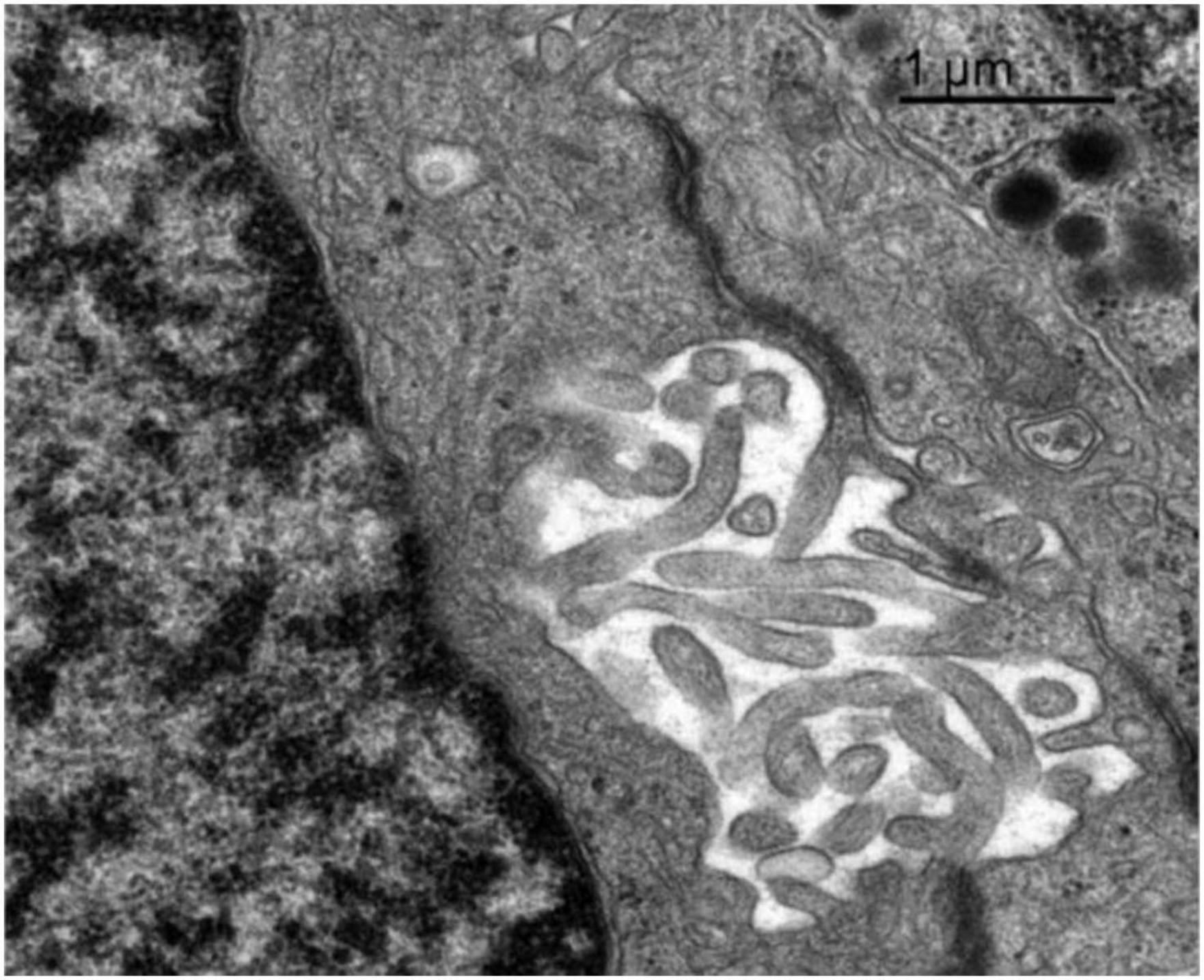 Transmission electron micrograph of a non-secretory follicular cell lining a follicular cavity in orca adenohypophysis. The cell shows numerous villi-like cytoplasmic projections extending into the lumen, suggesting roles in intercellular communication or follicular microenvironment regulation. Surrounding cellular matrix is visible. Scale bar indicates 1 micrometer.