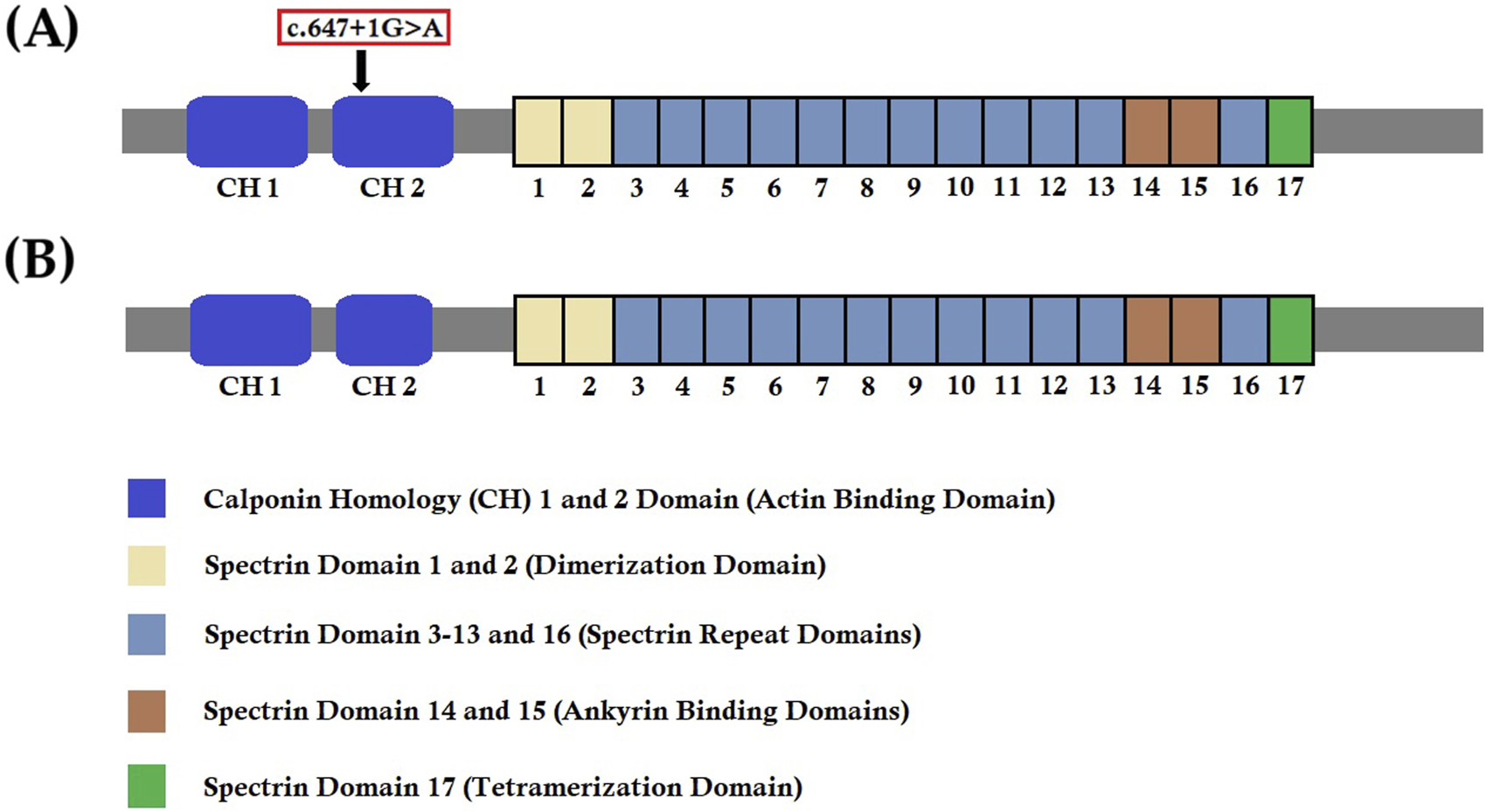 Diagram of protein domains for spectrin. Part A highlights a mutation, c.647+1G>A, affecting domains CH1 and CH2 (actin binding). Part B shows normal domains without the mutation. Domains are color-coded: blue for calponin homology, yellow for dimerization, light blue for spectrin repeats, brown for ankyrin binding, and green for tetramerization.