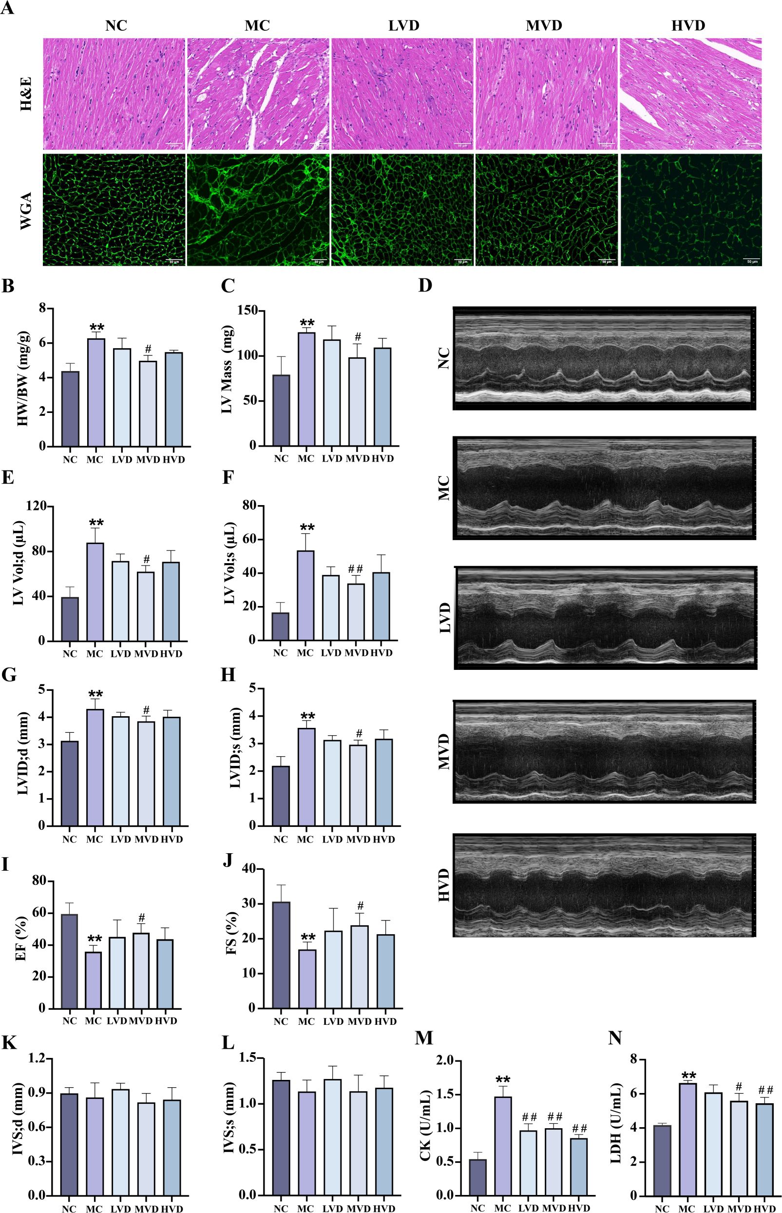 Microscopic images and graphs show cardiac tissue and measurements from different groups: NC, MC, LVD, MVD, and HVD. Panels A detail H&E and WGA stained tissues. Graphs B to N illustrate parameters like HW/BW ratio, LV mass, volumes, dimensions, ejection fraction, fractional shortening, IVS dimensions, CK, and LDH levels across groups. Echocardiography images in D show cardiac function for each group. Statistical significance is indicated with symbols.