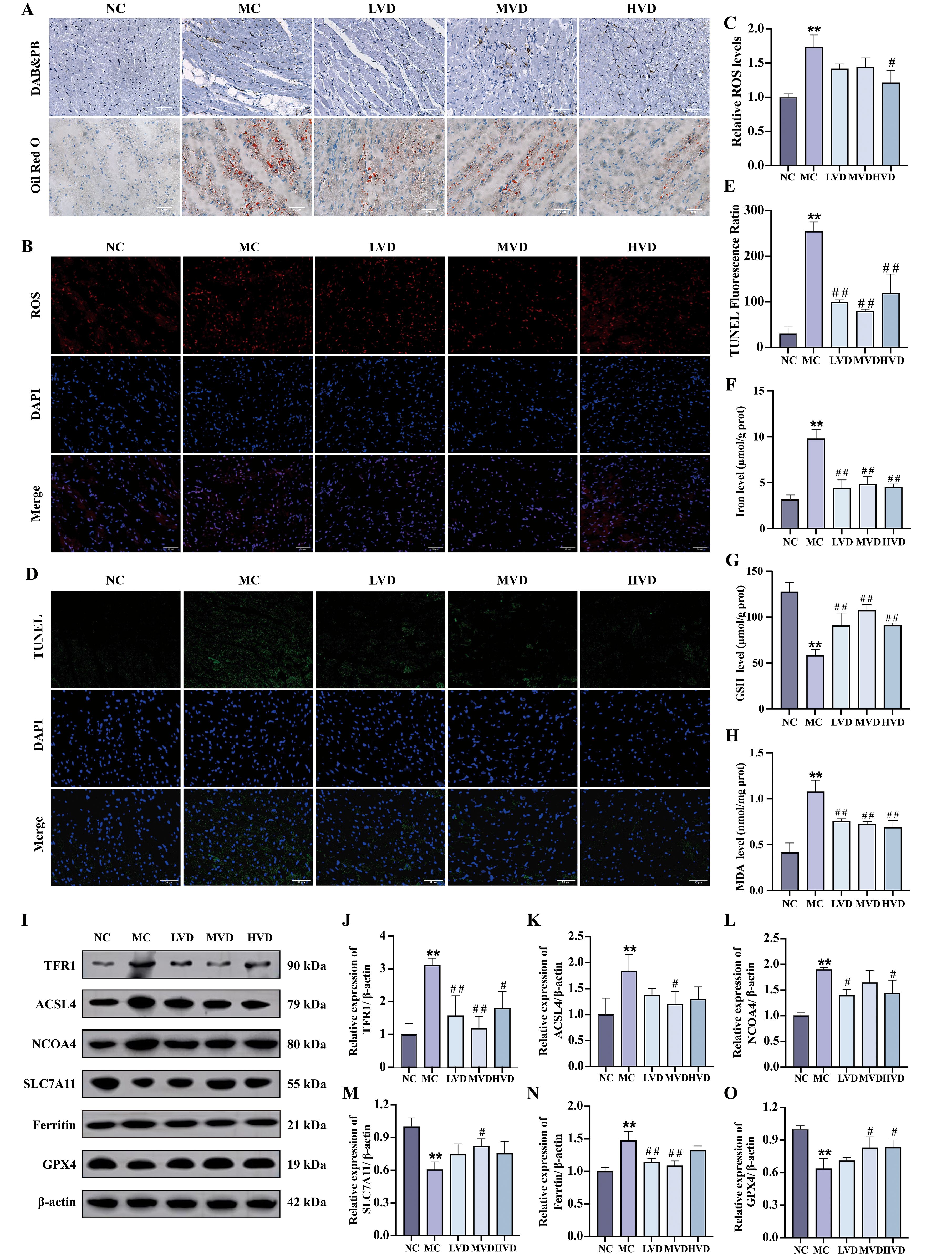 A series of scientific images and graphs showing different experiments and results. Panels A, B, and D display micrographs with labels NC, MC, LVD, MVD, HVD, and markers like ROS, DAPI, TUNEL, with merged overlays. Panels C, E, F, G, and H present bar graphs depicting measurements such as ROS levels, TUNEL fluorescence ratio, iron level, and others across the same conditions. Panel I shows Western blot results for proteins like TFR1, ACSL4, NCOA4, accompanied by graphs J to O quantifying protein expression relative to β-actin, illustrating varying expression levels across experimental conditions.