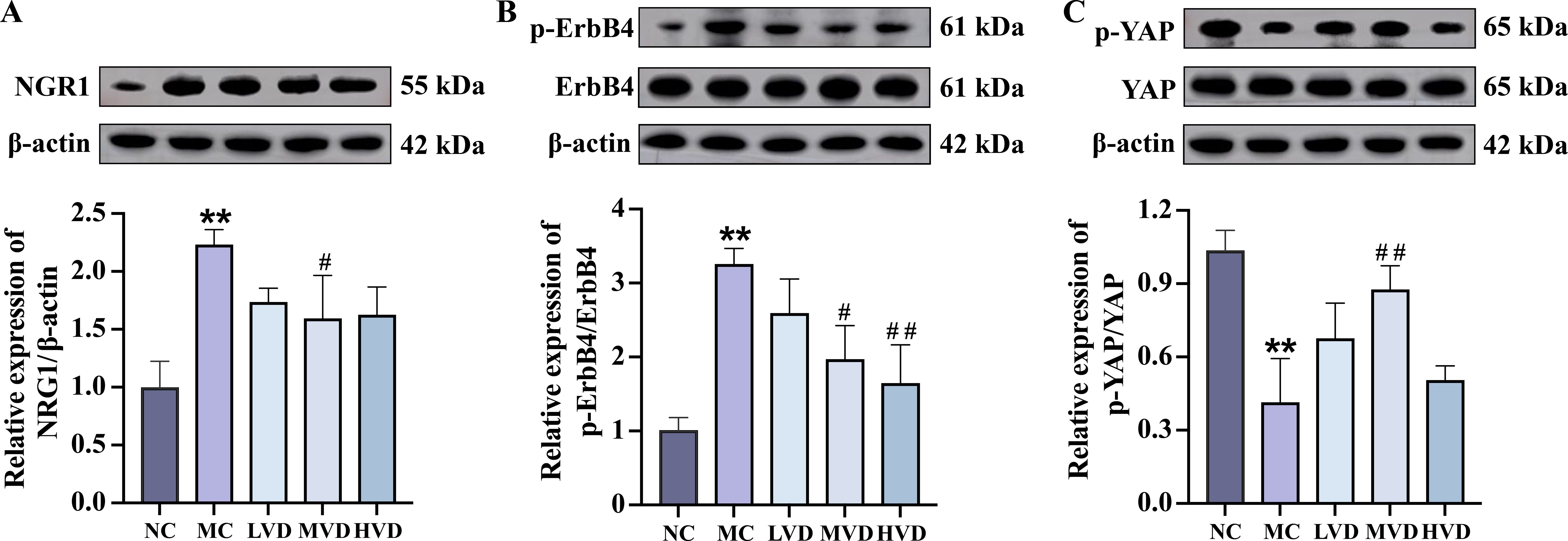 Western blot and bar graph results show protein expression levels for NGR1, p-ErbB4, and p-YAP, normalized to beta-actin, across different groups: NC, MC, LVD, MVD, and HVD. Significant differences are noted with asterisks and hash marks.
