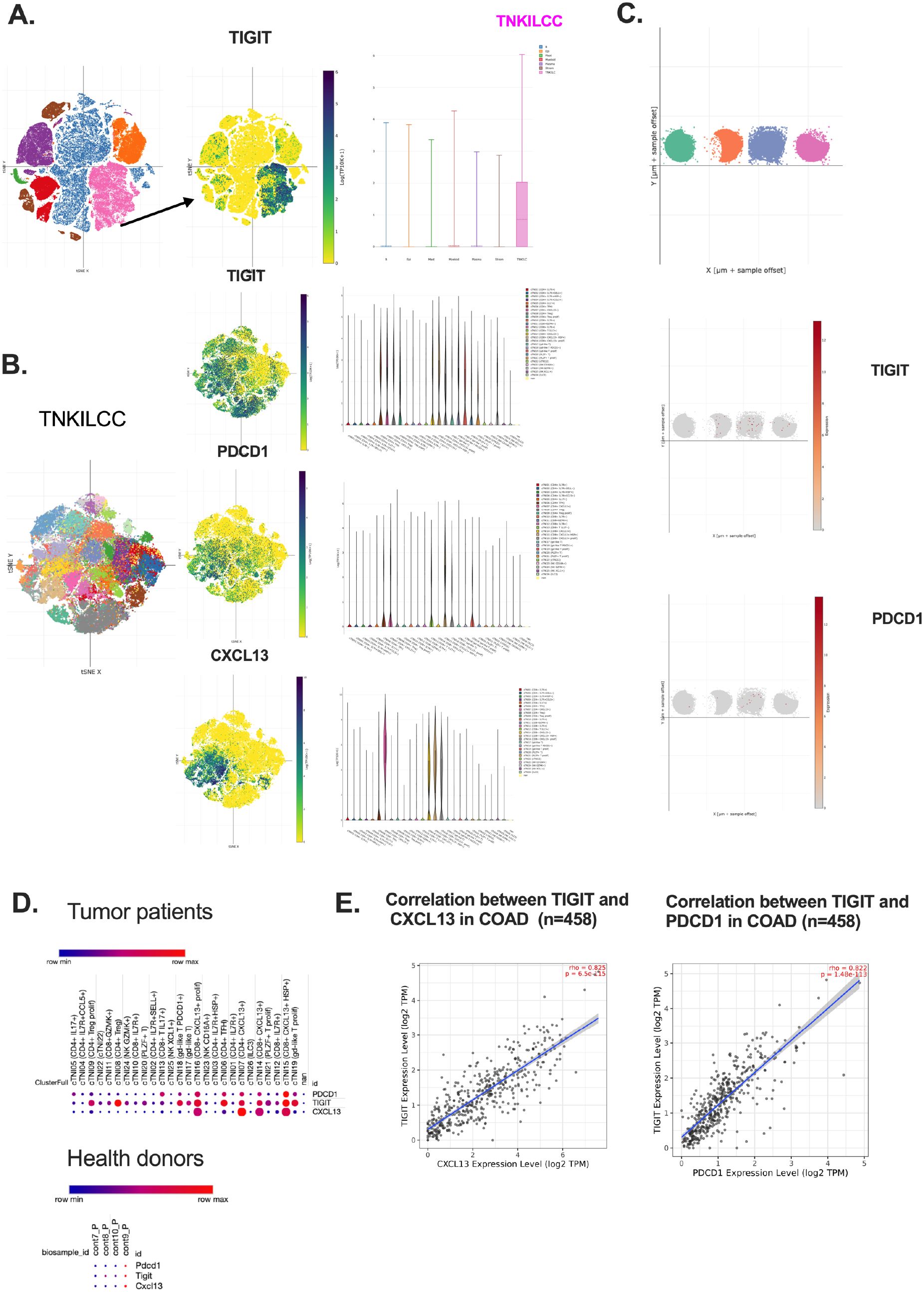 Various charts and graphs analyze data related to TIGIT, TNKILCC, and other markers. Panel A features a cluster plot highlighting TIGIT and TNKILCC expression. Panel B includes expression plots for TNKILCC, PDCD1, and CXCL13. Panel C displays scatter plots with expression offsets for TIGIT and PDCD1. Panel D compares expression levels in tumor patients and healthy donors. Panel E presents correlation graphs between TIGIT and CXCL13, and TIGIT and PDCD1 in colorectal cancer (COAD) with positive correlations noted.