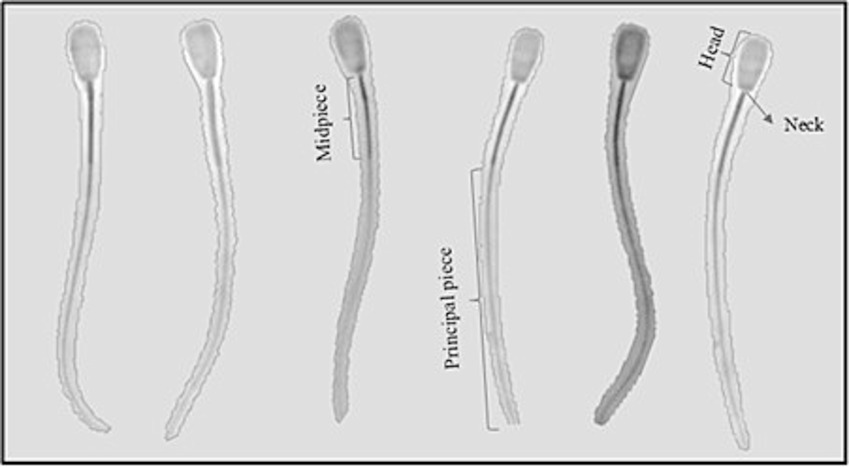 Illustration of six sperm cells. Each cell shows a head, neck, midpiece, and principal piece. The labels indicate specific parts: