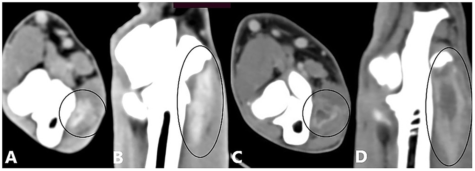 CT scan images labeled A, B, C, and D, showing axial and sagittal views. Highlighted areas in each image, circled, indicate regions of interest, possibly for medical examination or diagnosis.