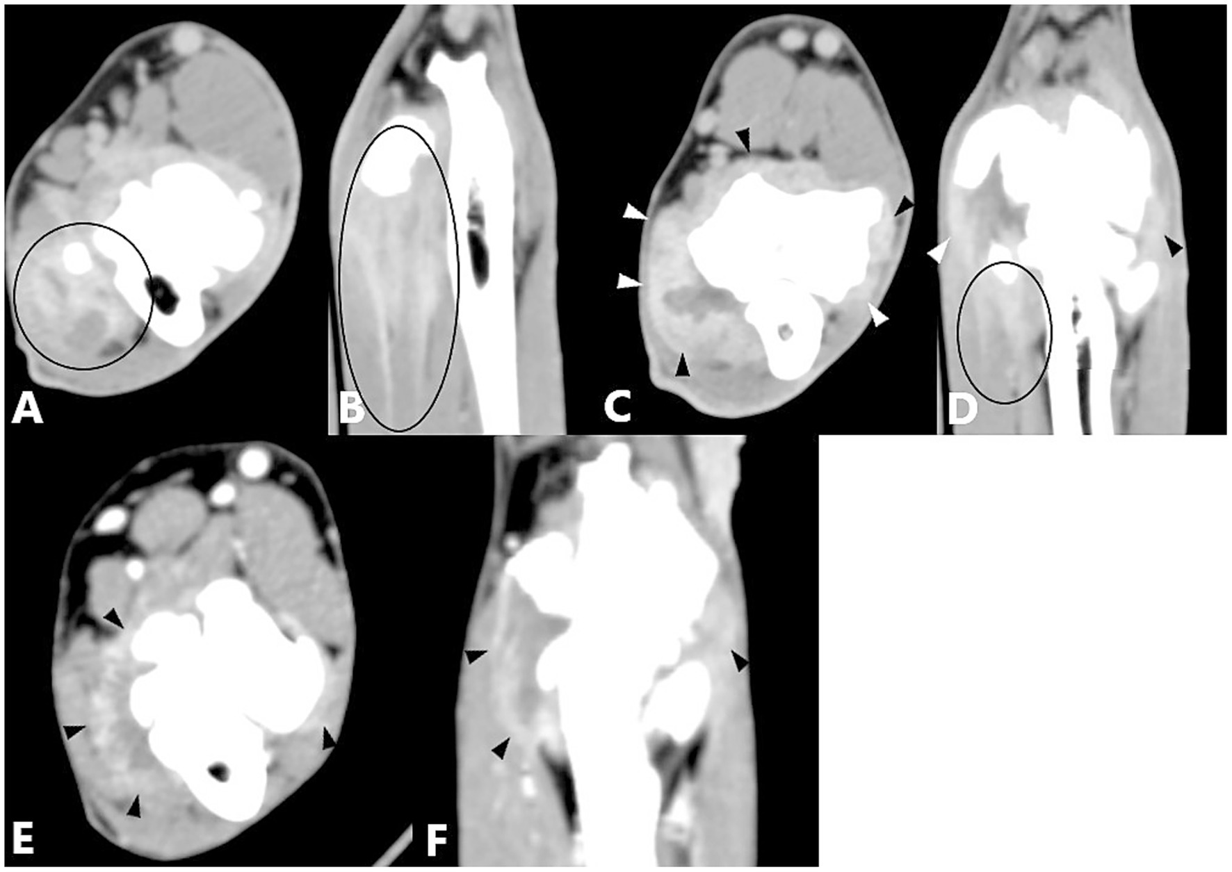 CT scan images labeled A to F, showing cross-sectional and longitudinal views of an anatomical area with notable differences. White and dark areas indicate varying tissue densities. Arrows and circles highlight particular regions for analysis.