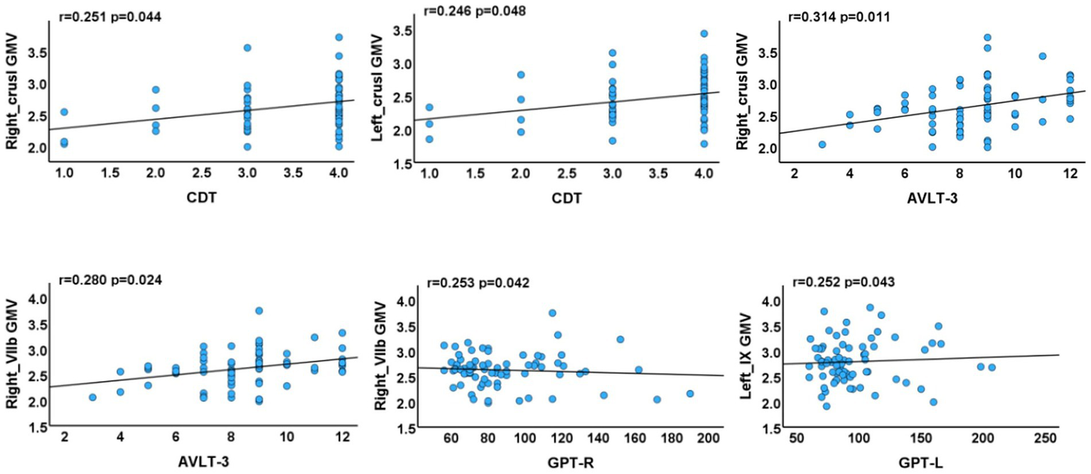 Scatter plots showing correlations between different GMV metrics and variables. Top row: Right and Left Crus I GMV vs. CDT with r-values 0.251 and 0.246, and Right Crus I GMV vs. AVLT-3 with r-value 0.314. Bottom row: Right VIIb GMV vs. AVLT-3 with r-value 0.280, Right VIIb GMV vs. GPT-R with r-value 0.253, and Left IX GMV vs. GPT-L with r-value 0.252. All plots show positive correlations with respective p-values.