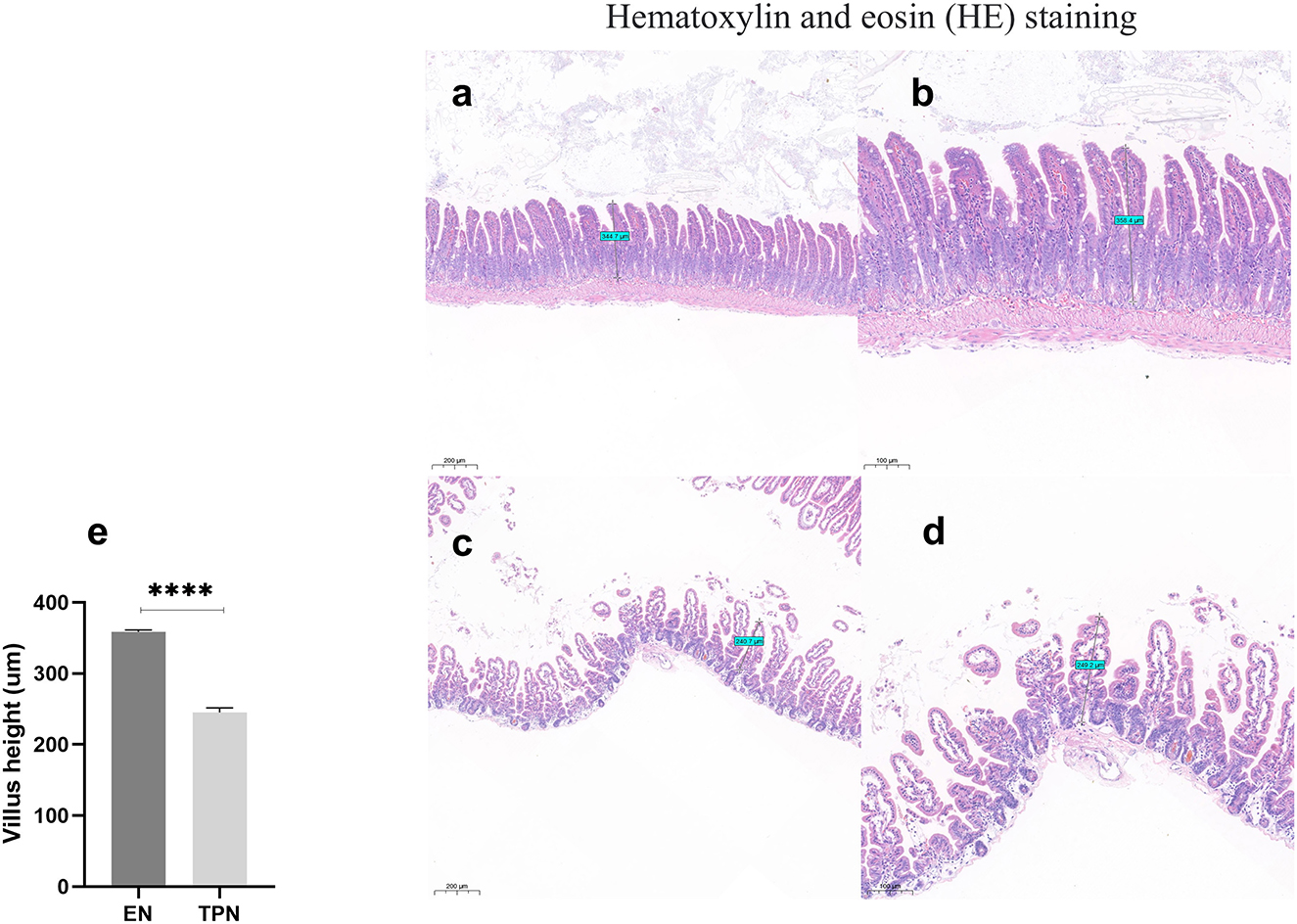 Histological images of intestinal tissue sections stained with hematoxylin and eosin, labeled a to d, are shown. Panels a and b represent the EN group with scale bars of one hundred millimeters and fifty millimeters, respectively. Panels c and d depict the TPN group, with the same scale bars. Additionally, a bar graph (e) illustrates villus height comparisons between EN and TPN groups, showing significantly higher measurements in the EN group.