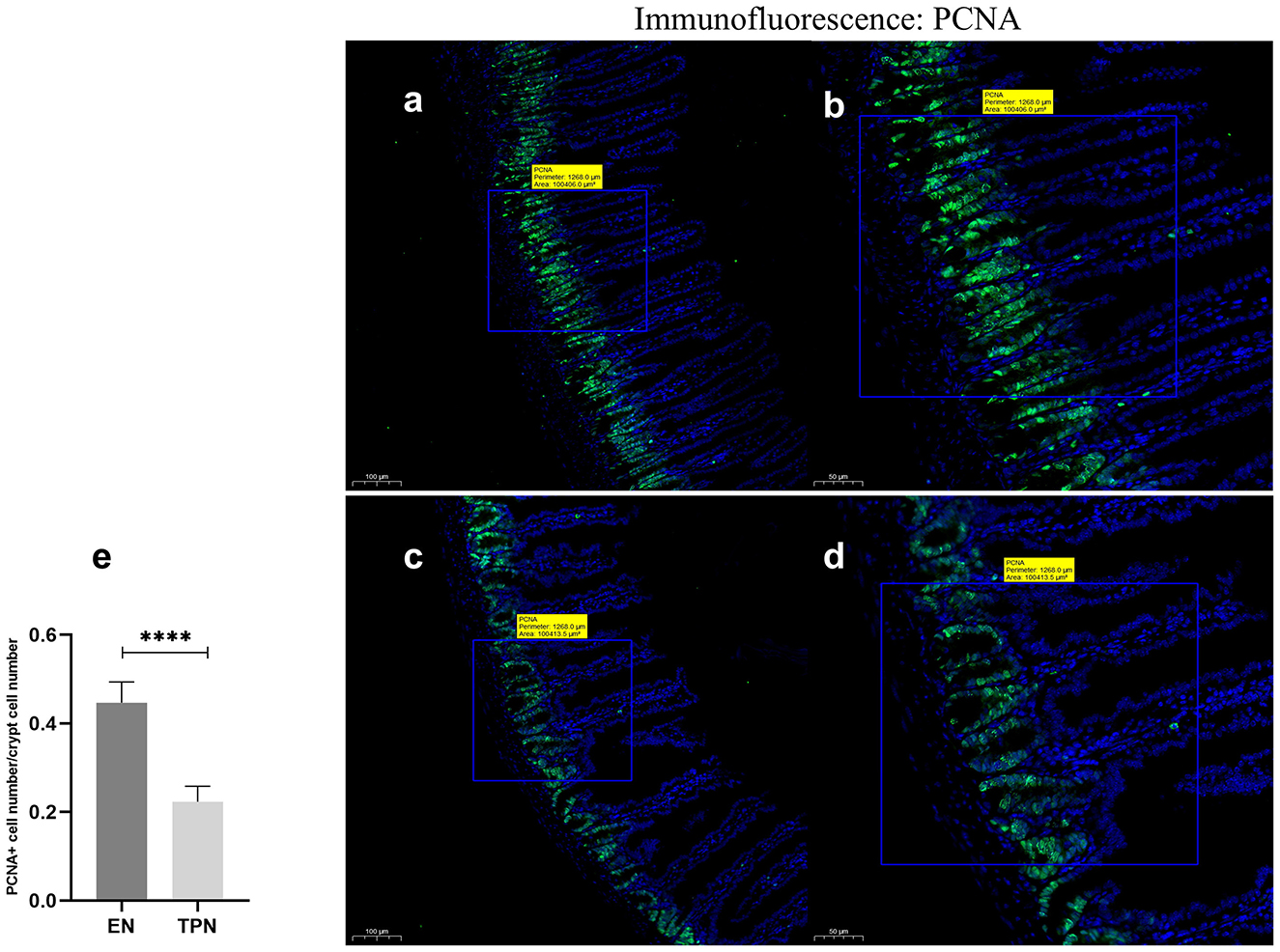 Immunofluorescence images labeled “PCNA” depict stained samples, with panels a and b from the TPN group showing magnifications at 100 mm and 50 mm scale bars. Panels c and d from the EN group have similar scale bar measurements. A bar chart labeled “e” compares PCNA+ cell numbers between the EN and TPN groups, showing significantly higher values in the EN group (P < 0.001).